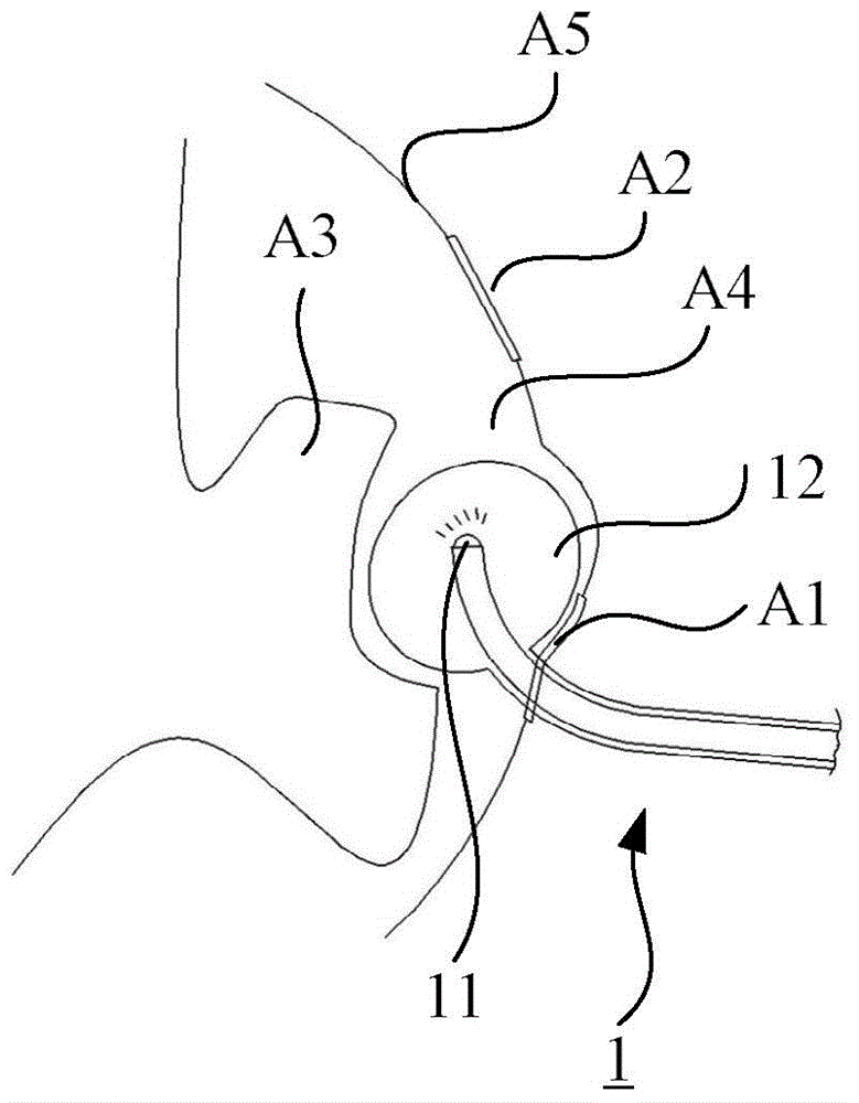 Pericardium endoscope, lasso device and heart left aurcle closing system