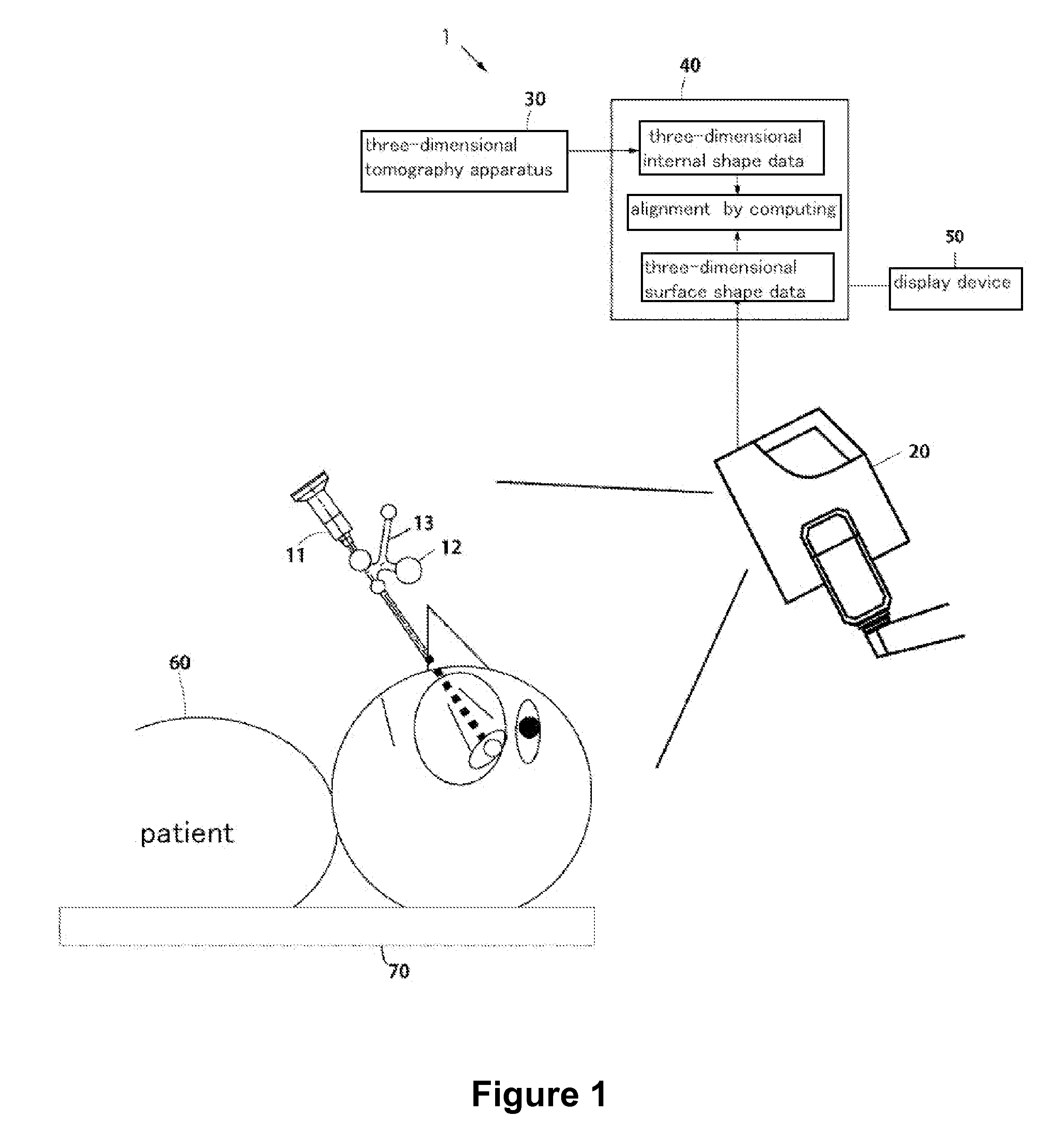 Surgery assistance system