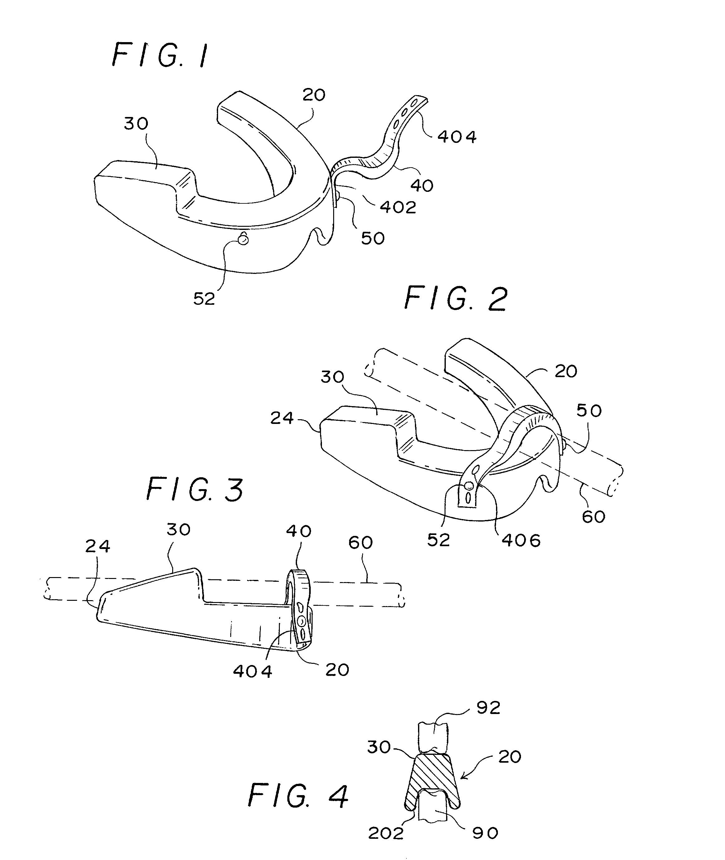 Catheter securing device