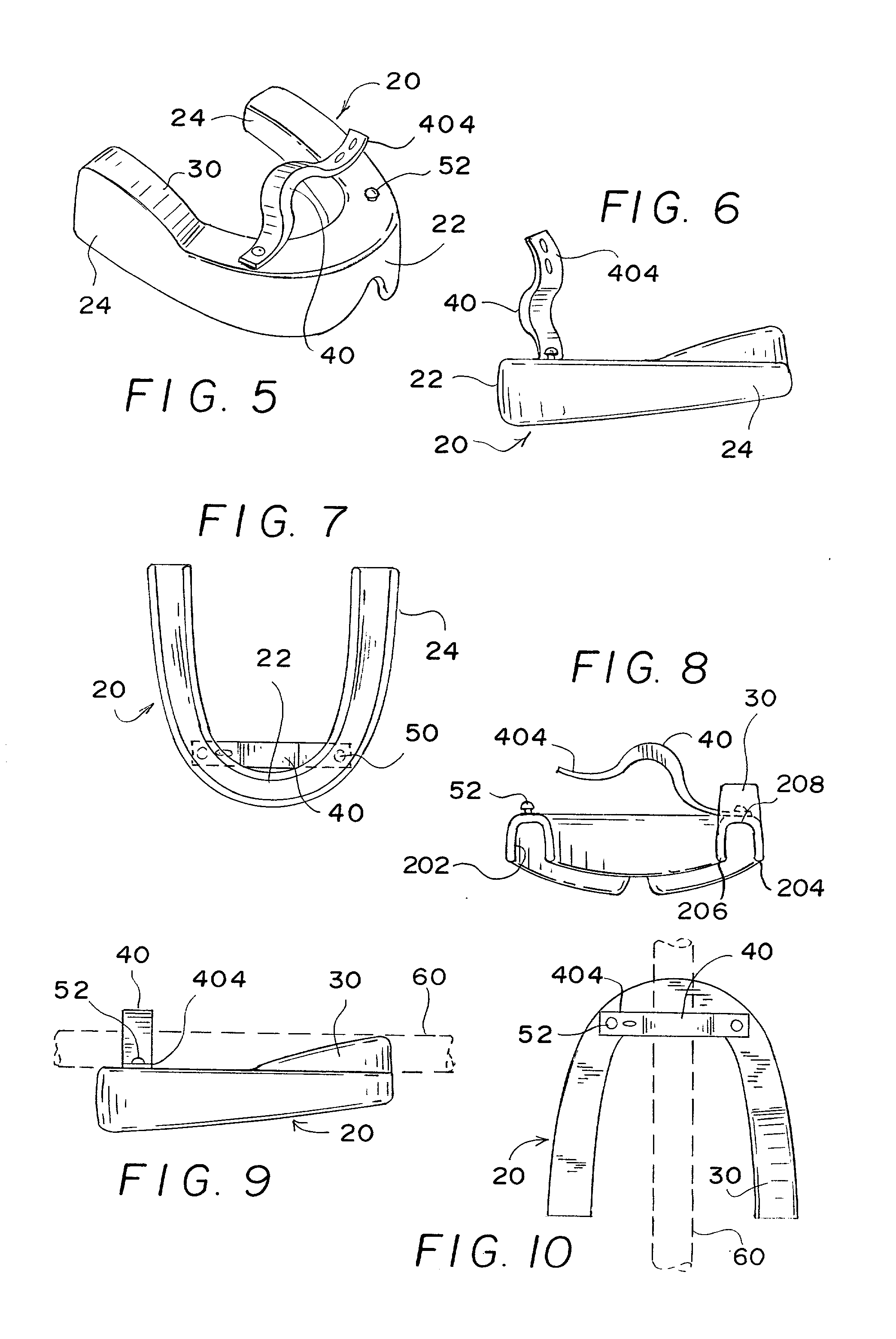 Catheter securing device
