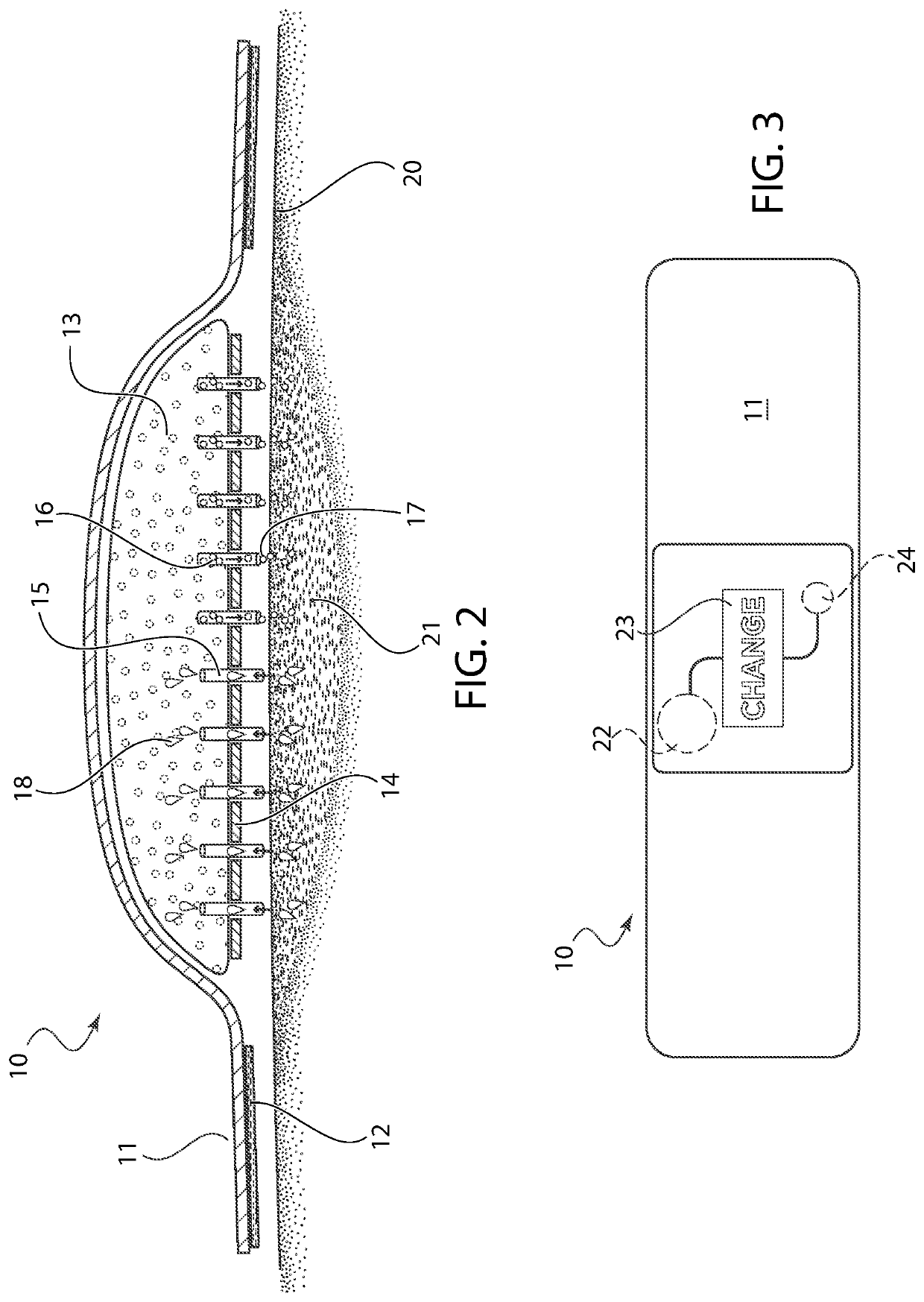Bandage with microneedles for antimicrobial delivery and fluid absorption from a wound
