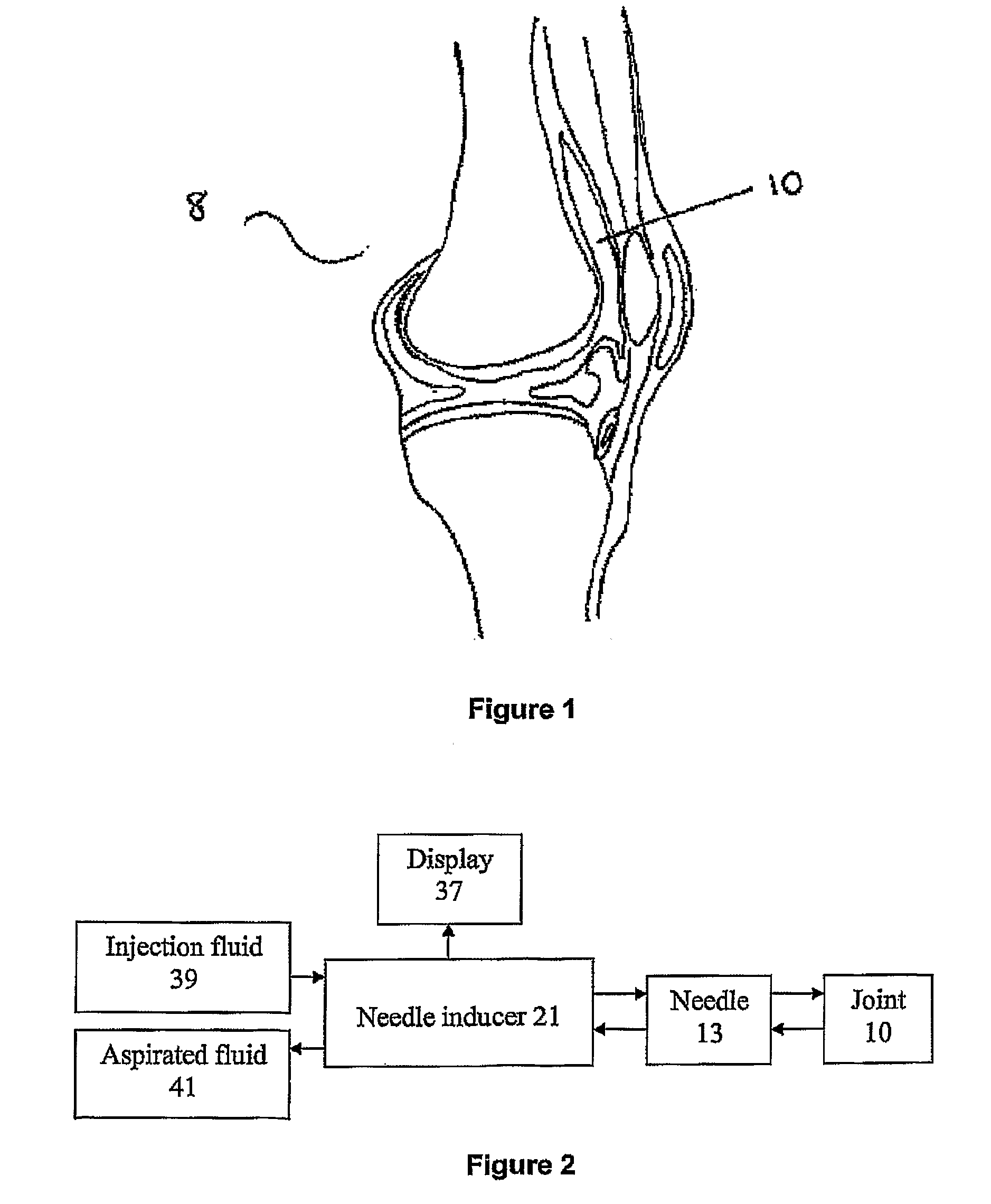 Method and apparatus for intra-articular injection or aspiration