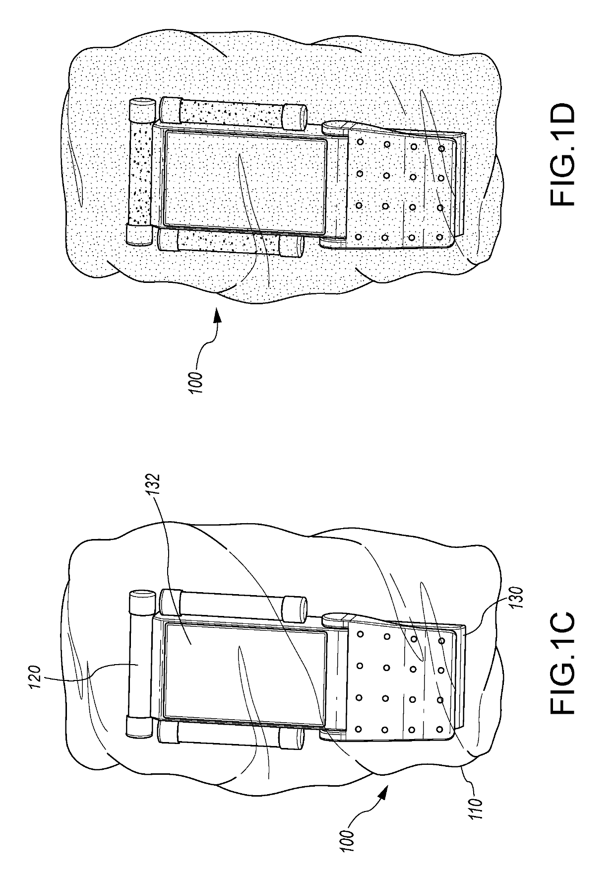 UV light illuminated surgical covering apparatus and method