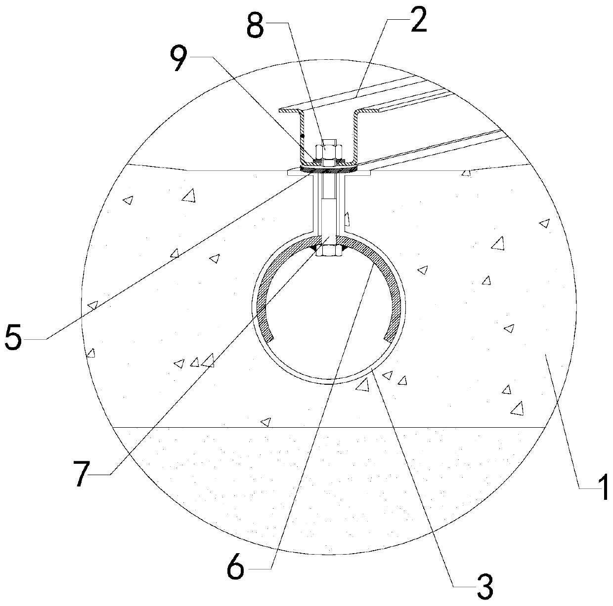 V-shaped urinary catheter excrement channel improvement and construction mounting device