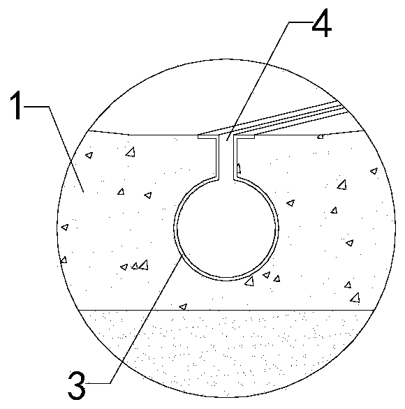 V-shaped urinary catheter excrement channel improvement and construction mounting device