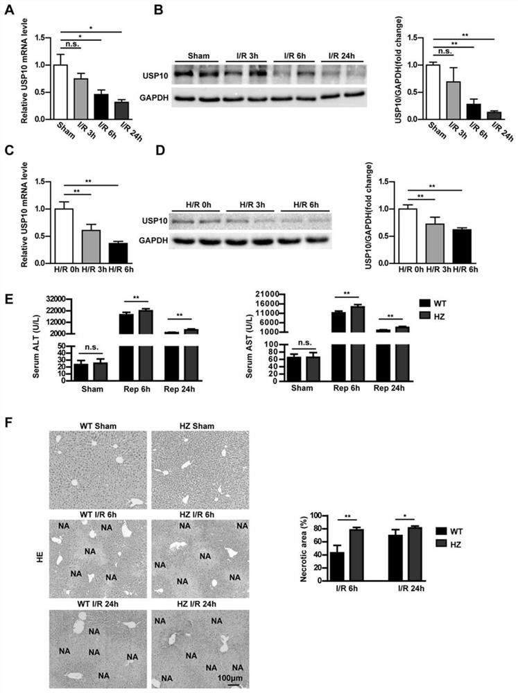 Application of USP10 in hepatic ischemia reperfusion injury
