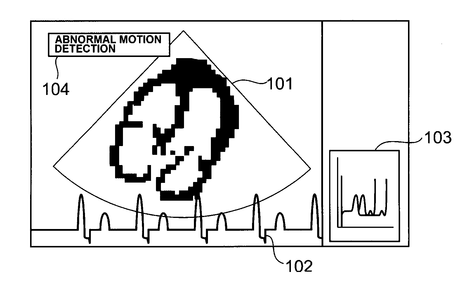 Ultrasonic imaging apparatus, a method for displaying a diagnostic image, and a medical apparatus