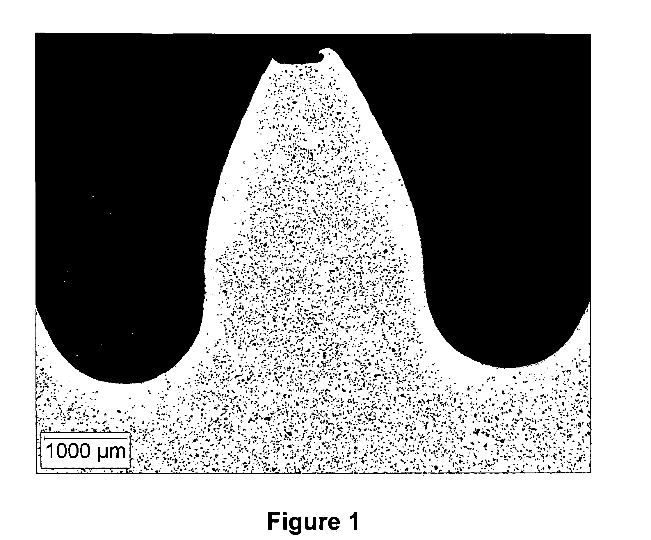 Sintered metal parts and method for the manufacturing thereof