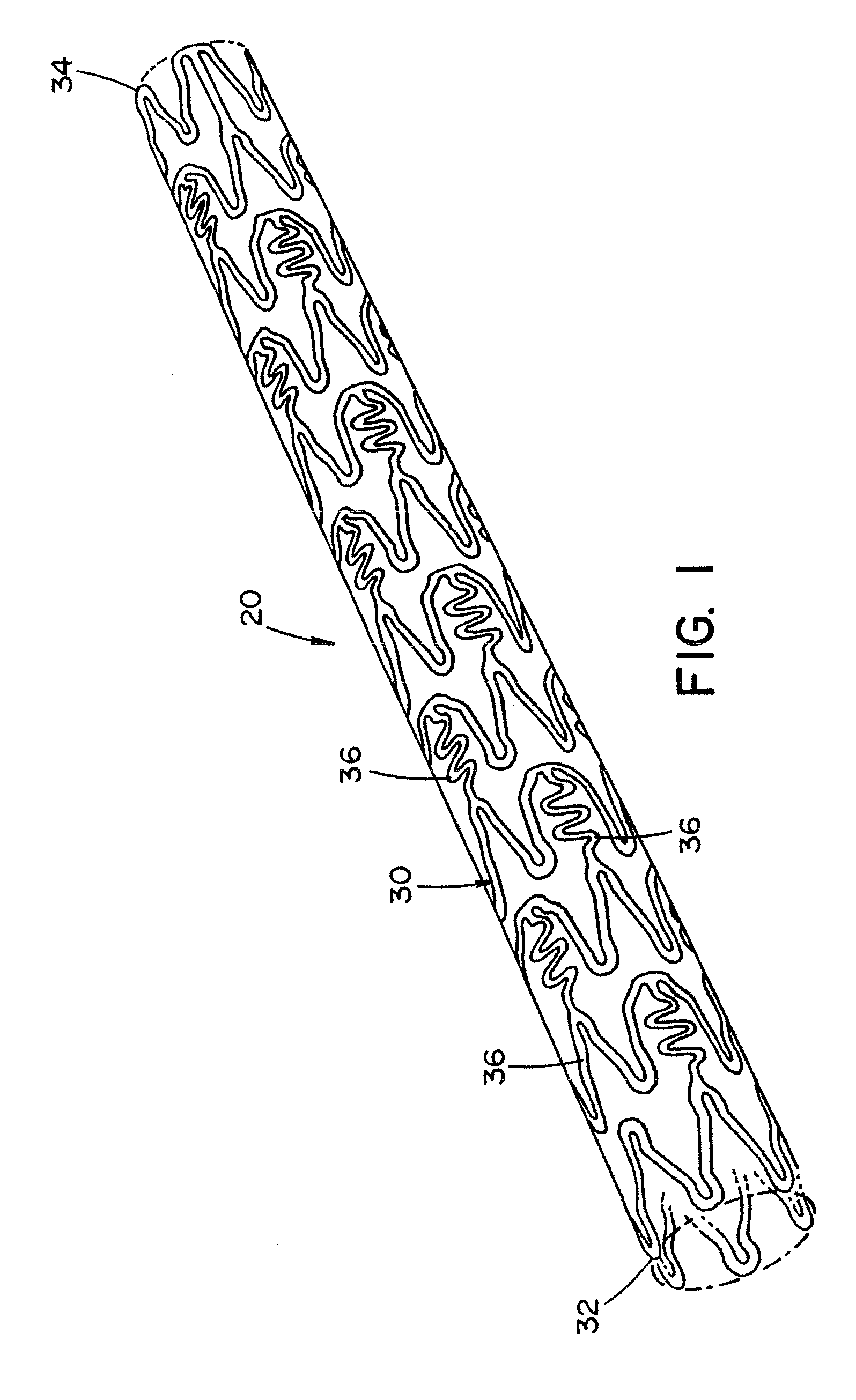 Method for forming a tubular medical device