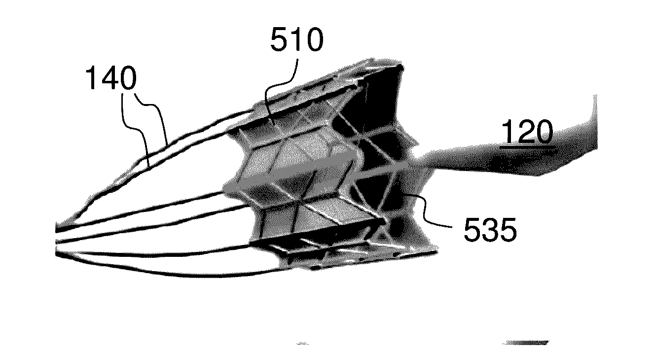 Actively Controllable Heart Valve Implant and Method of Controlling Same