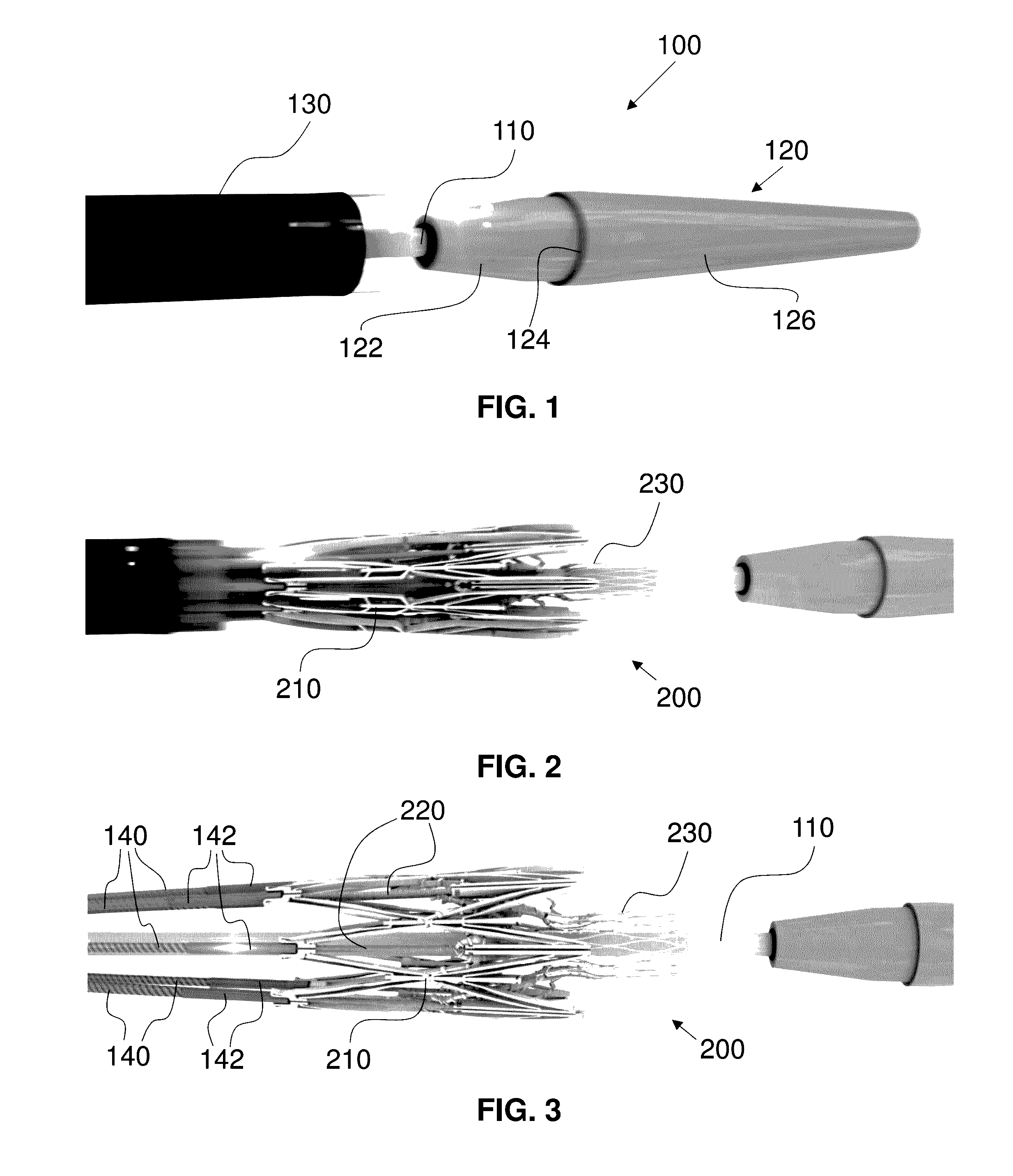 Actively Controllable Heart Valve Implant and Method of Controlling Same