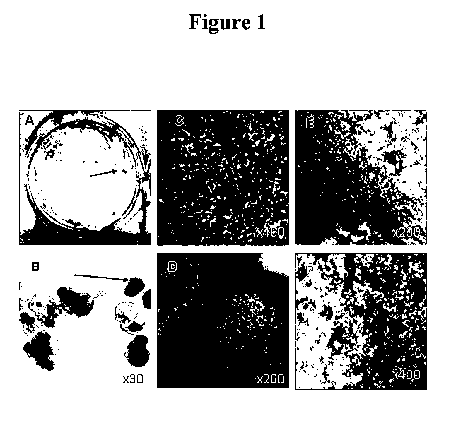 Methods for producing enriched populations of human retinal pigment epithelium cells for treatment of retinal degeneration