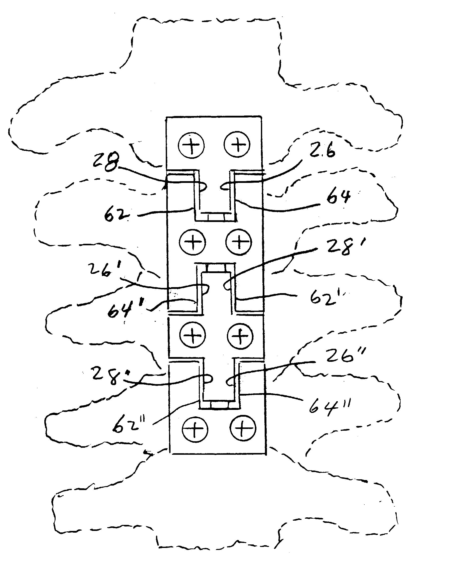 Methods and apparatuses for promoting fusion of vertebrae