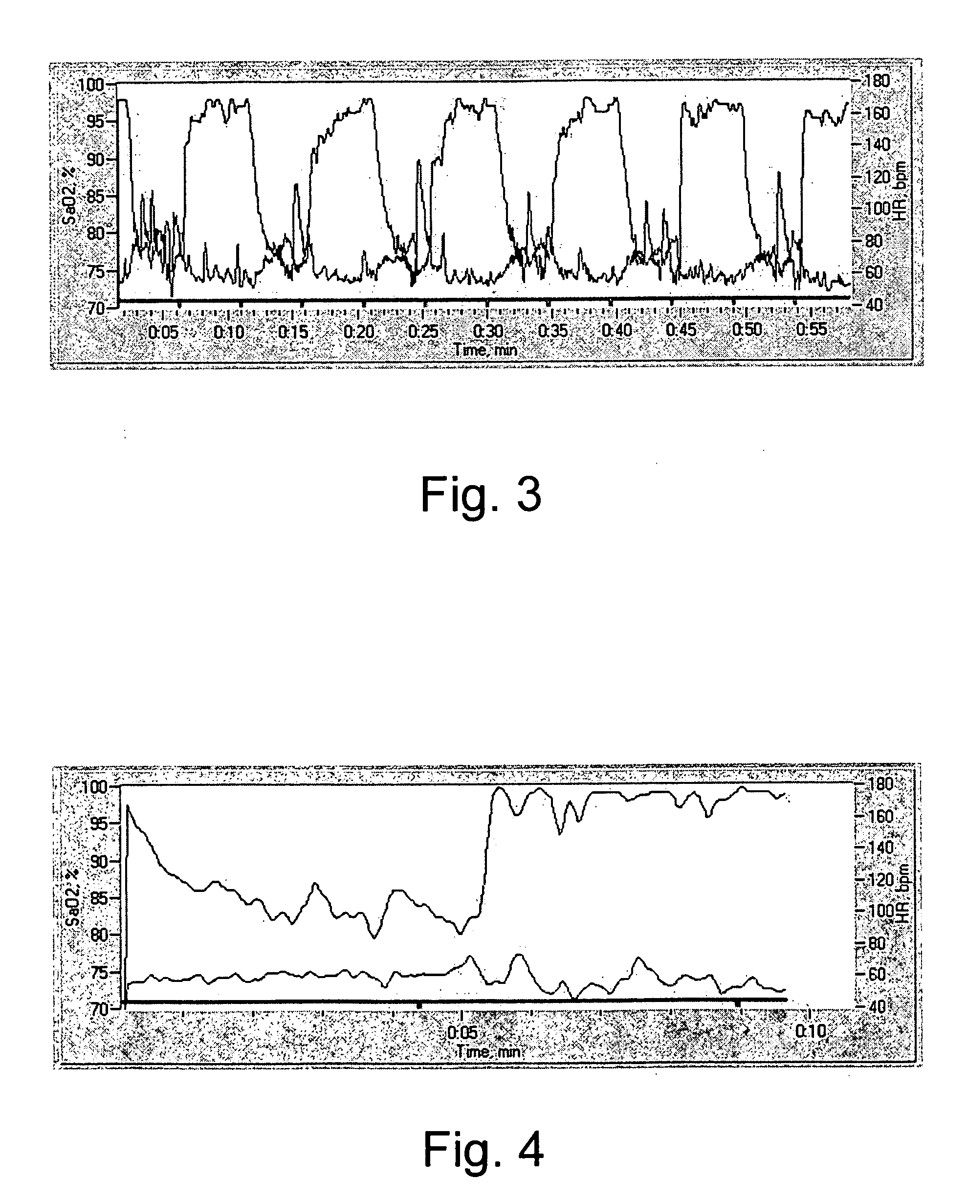 Method and apparatus for intermittent hypoxic training