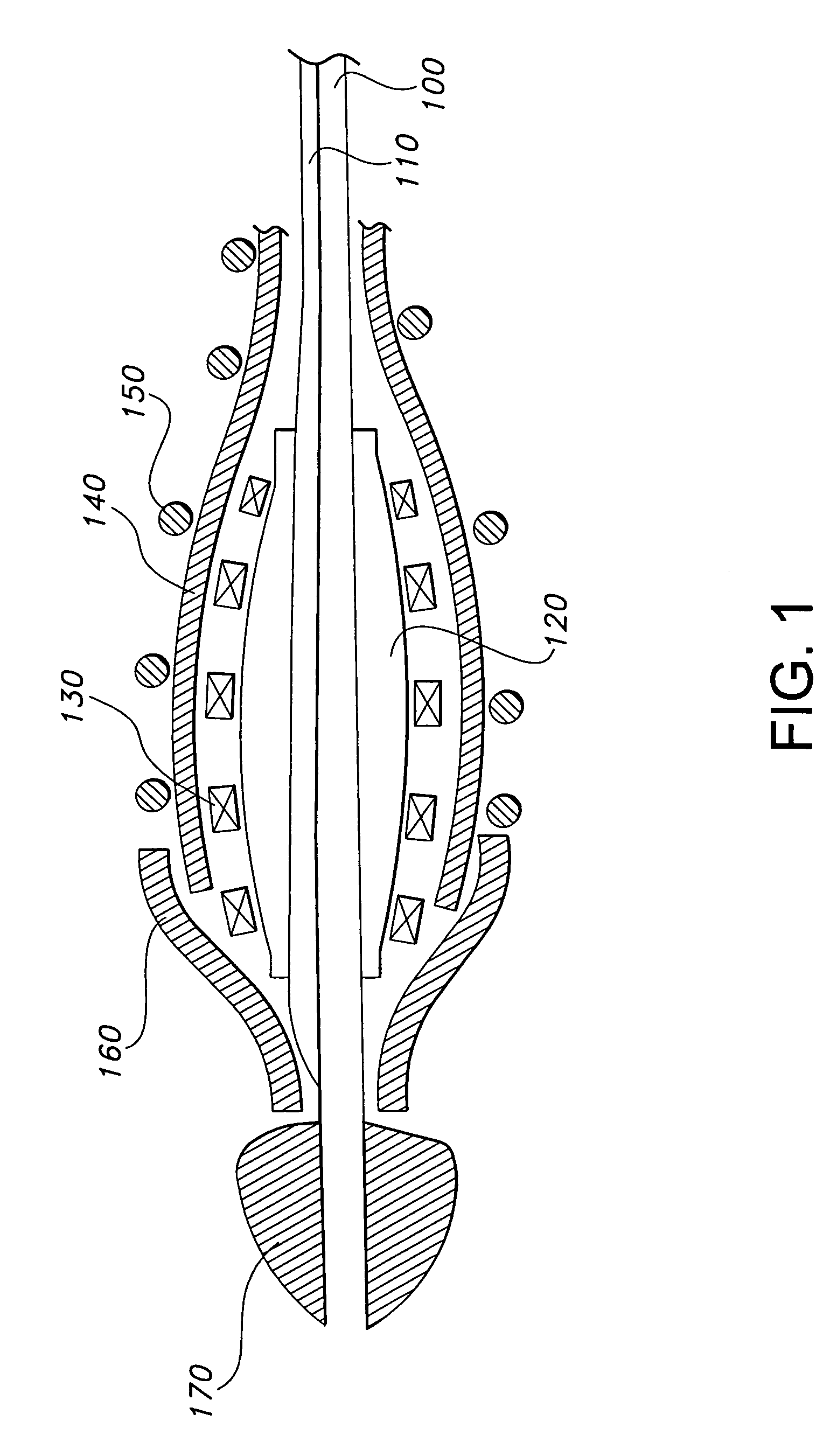 Method for inserting a prosthesis