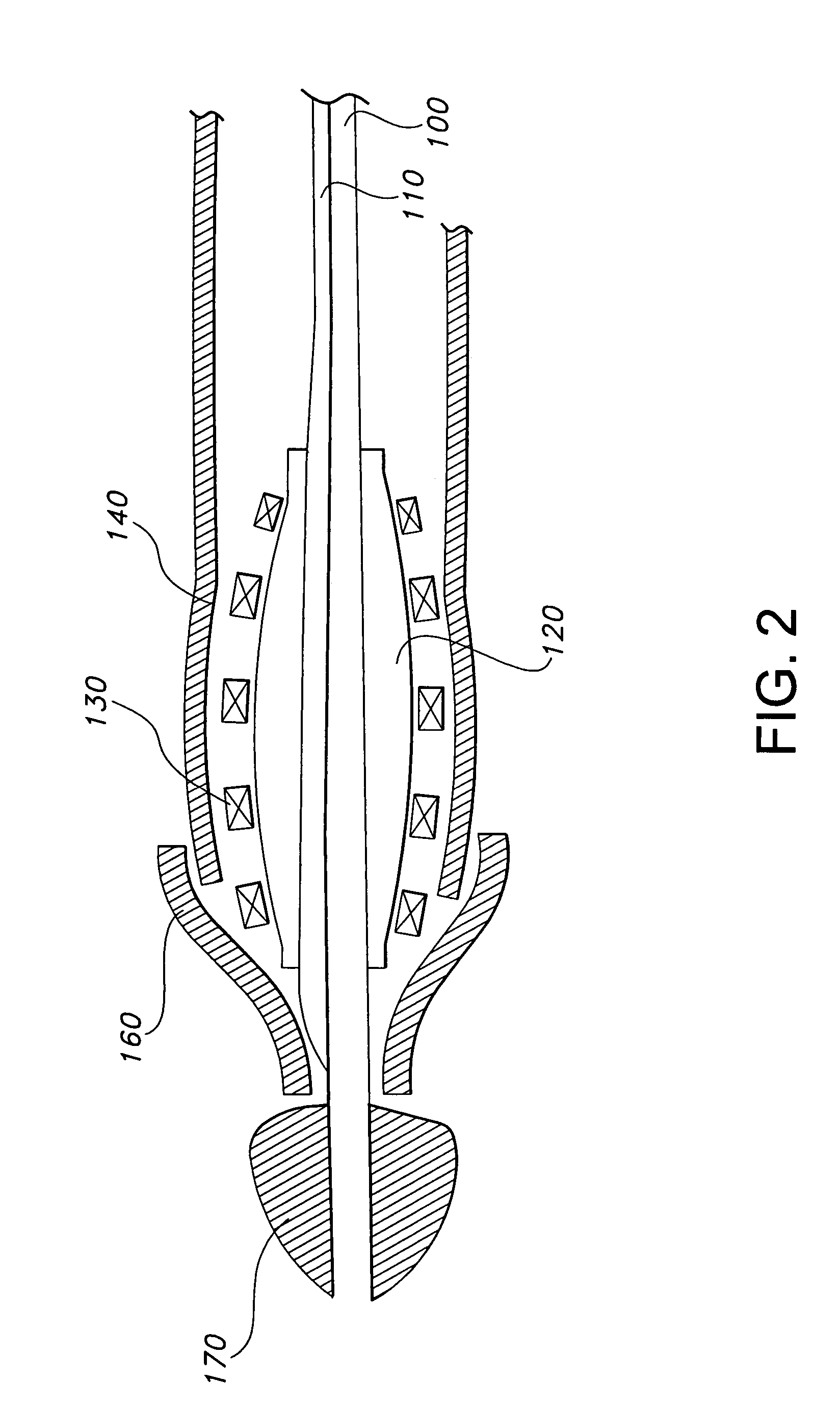 Method for inserting a prosthesis