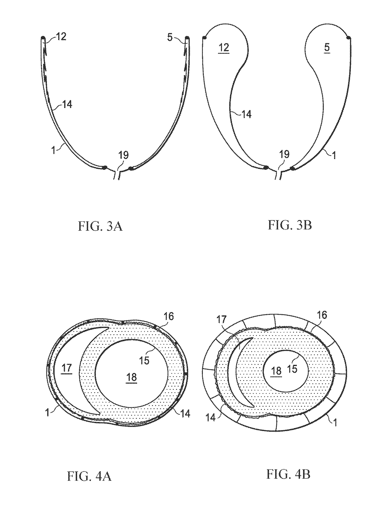 Fully implantable direct cardiac and aortic compression device