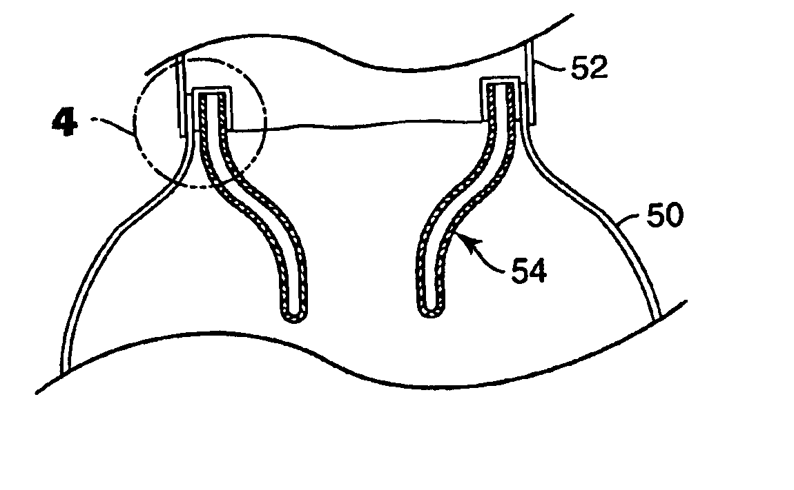Personal protective suit with partial flow restriction