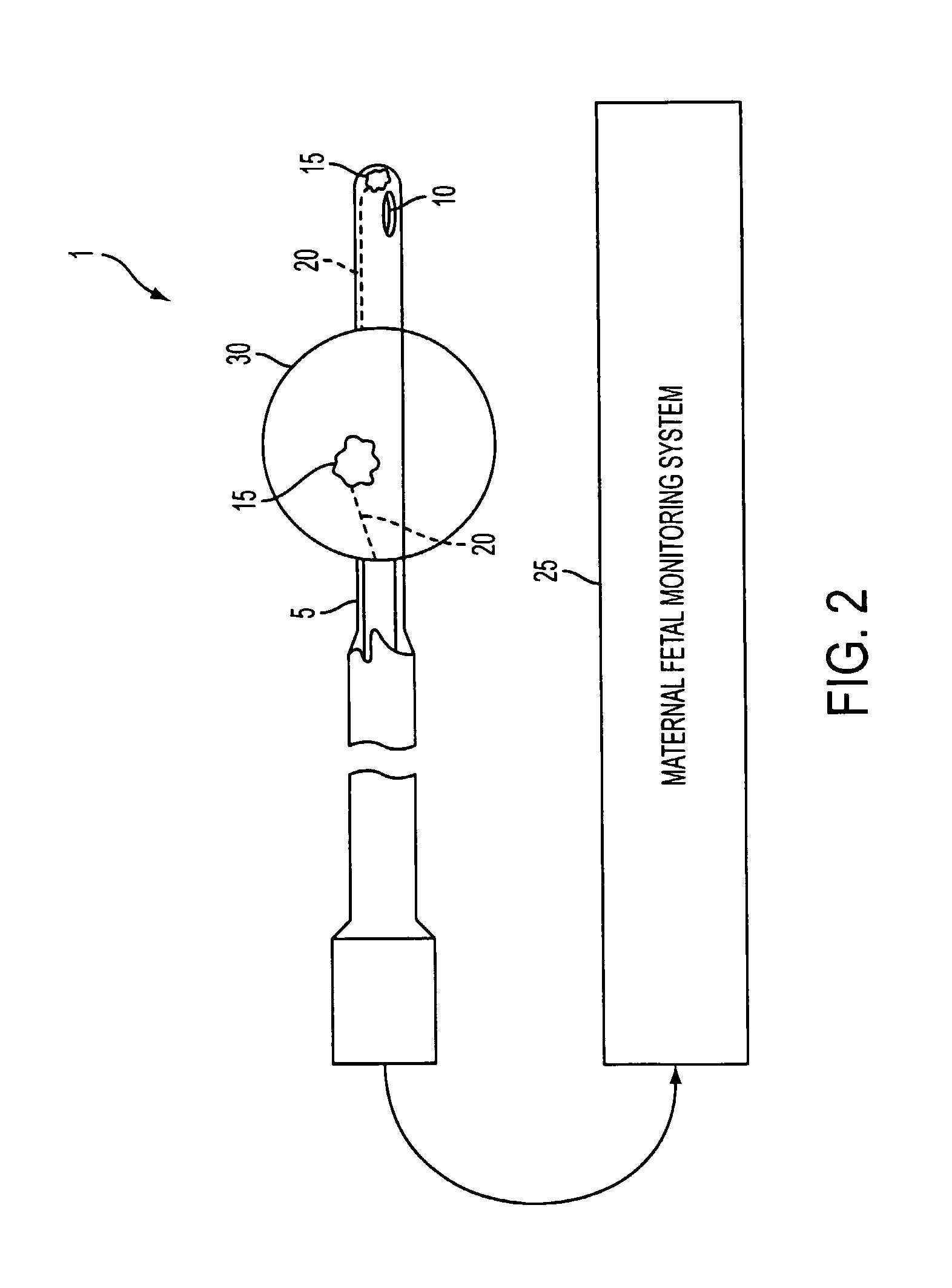 Novel Catheter Sensor