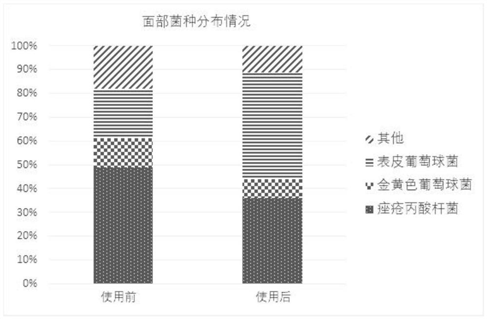 Composition for removing acnes and repairing skin barrier, and preparation method and application of composition