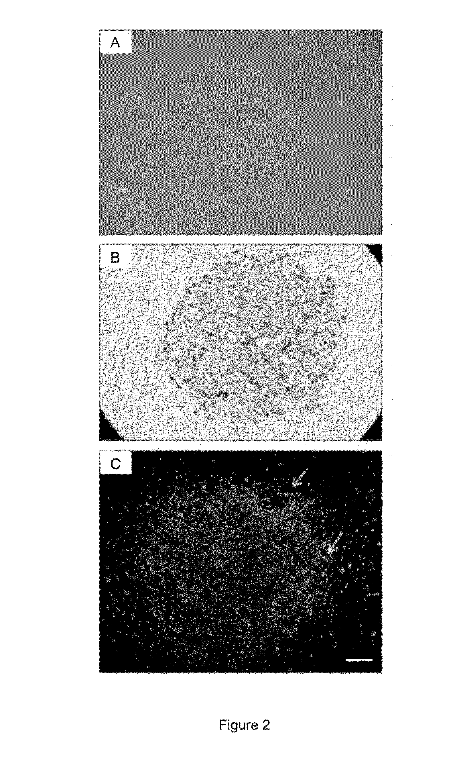 Myogenic differentiation of stem cells and uses thereof
