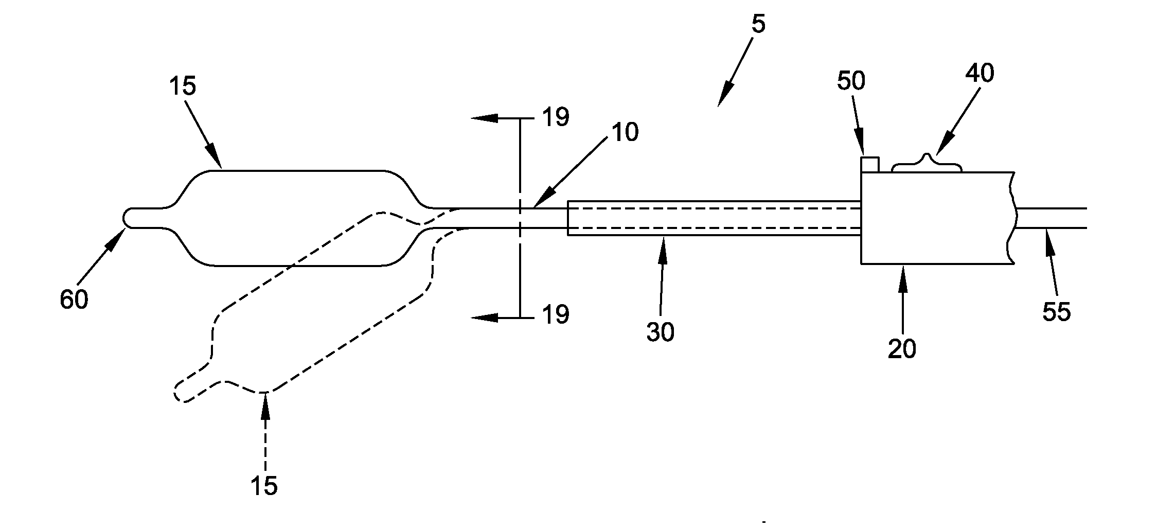 Method and apparatus for distracting a joint