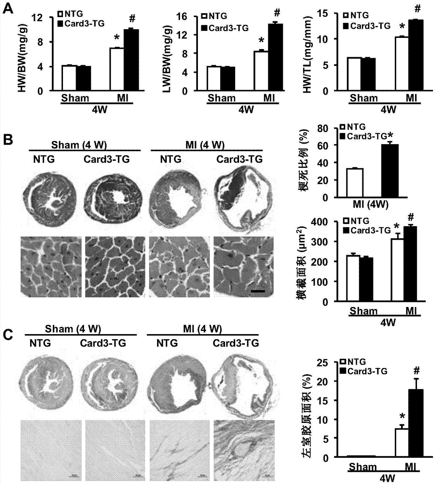 Function and application of Caspase activation and recruitment domain 3 (Card3) gene in coronary atherosclerotic heart disease
