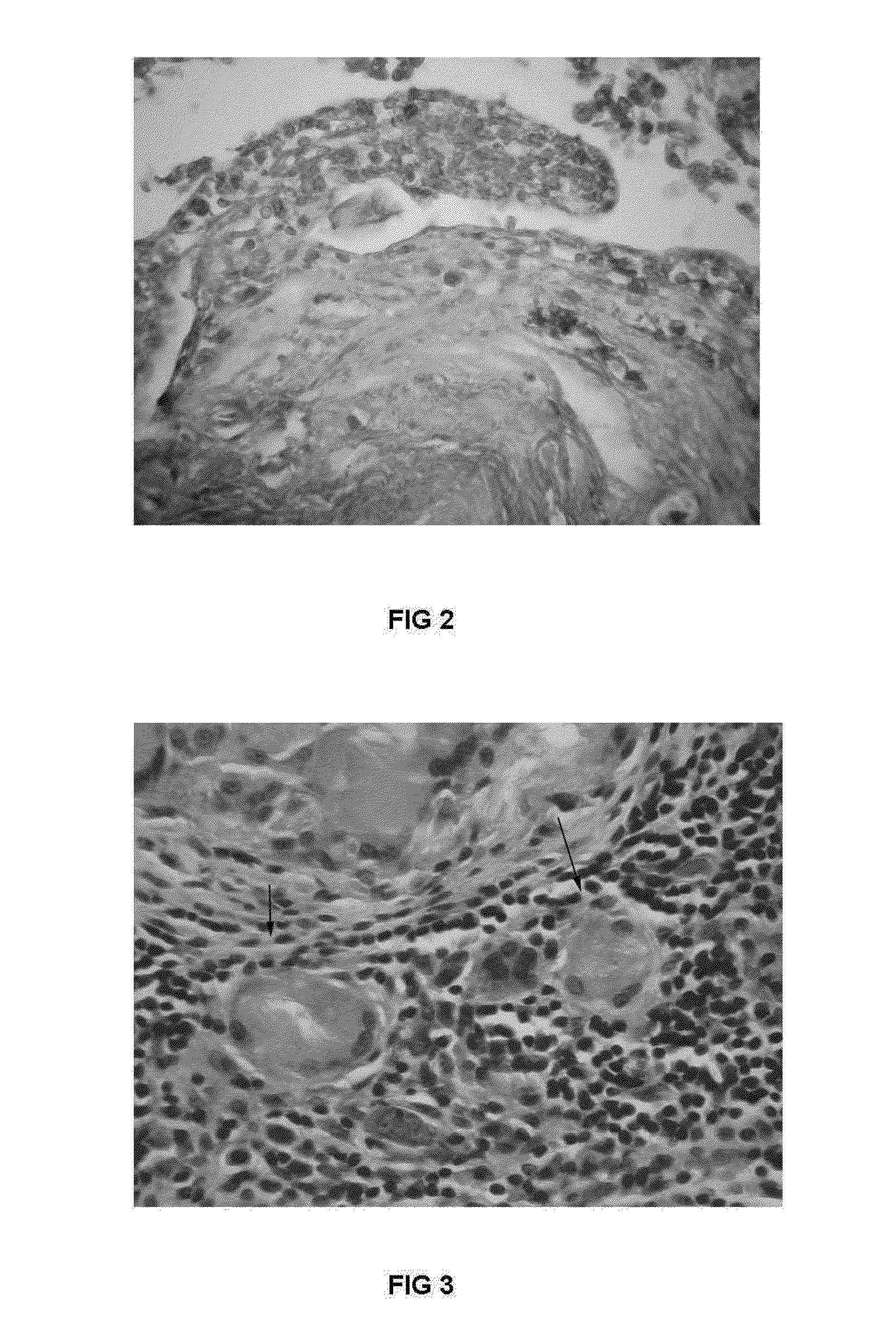 Thixotropic biological adhesive for use in internal body cavities