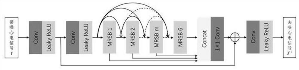 An ECG Signal Noise Reduction Method Based on Improved Residual Dense Network