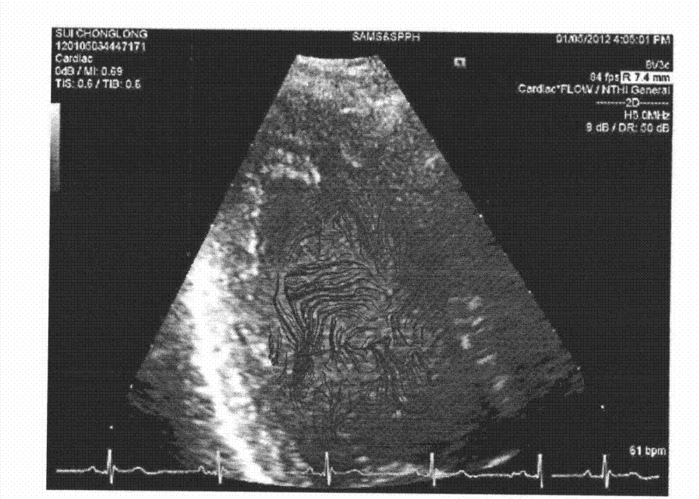 Method for analyzing velocity vector of flow field of heart based on gray scale ultrasound image
