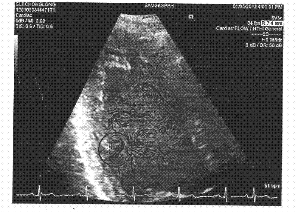 Method for analyzing velocity vector of flow field of heart based on gray scale ultrasound image