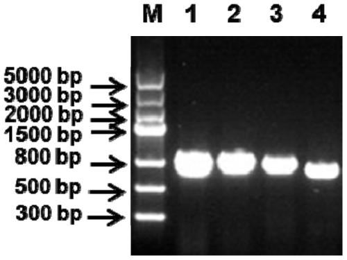 Universal kit for detection of different genotypes of infectious bronchitis virus