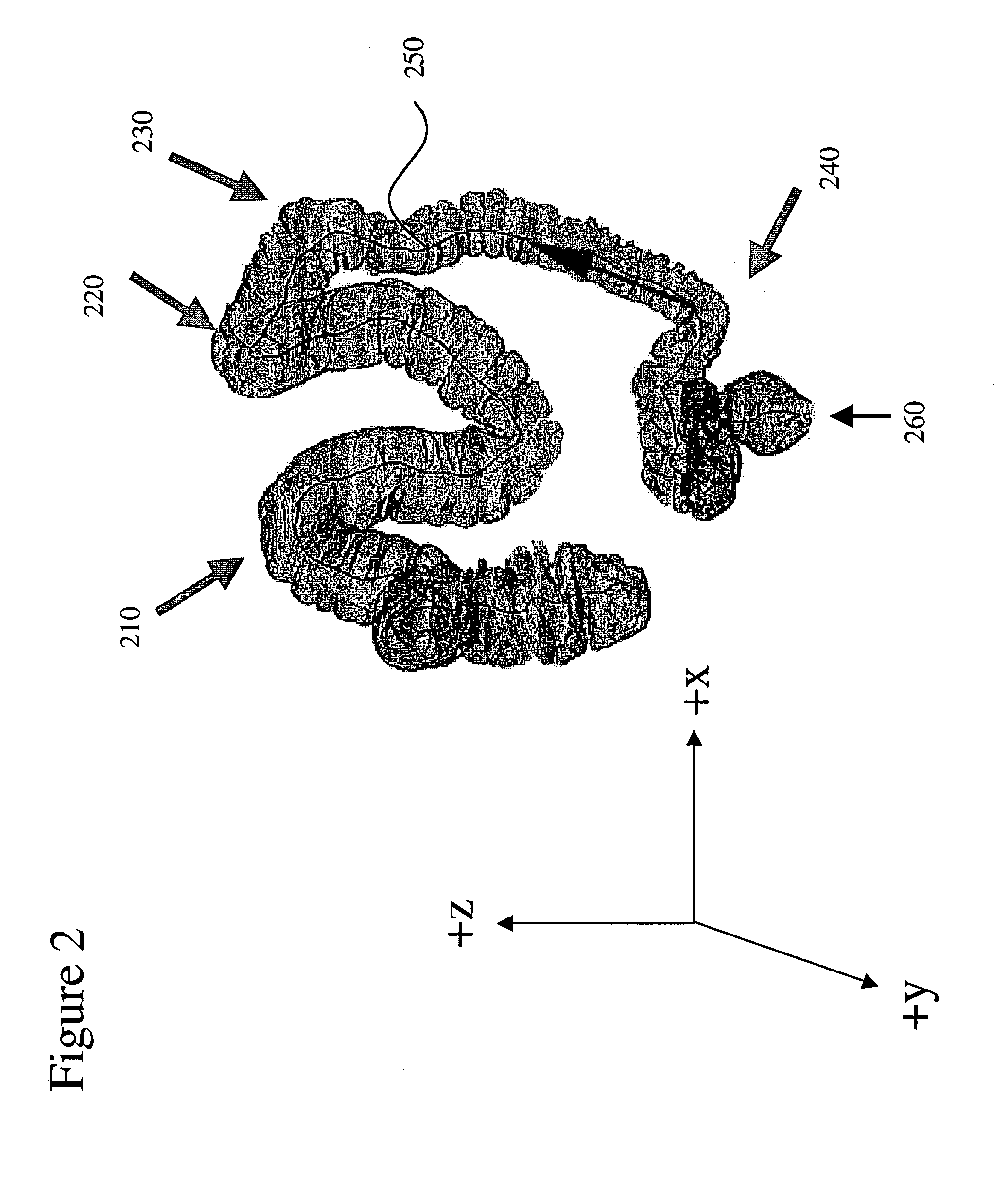Method for matching and registering medical image data