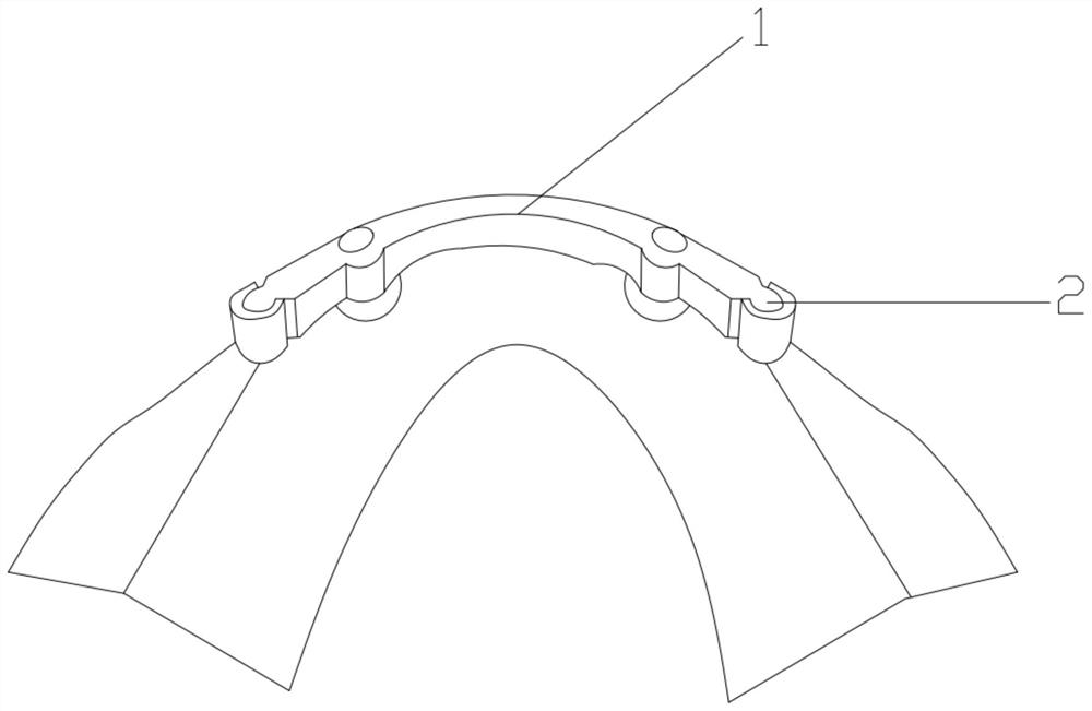 Use method of key and key way attachment for dental department