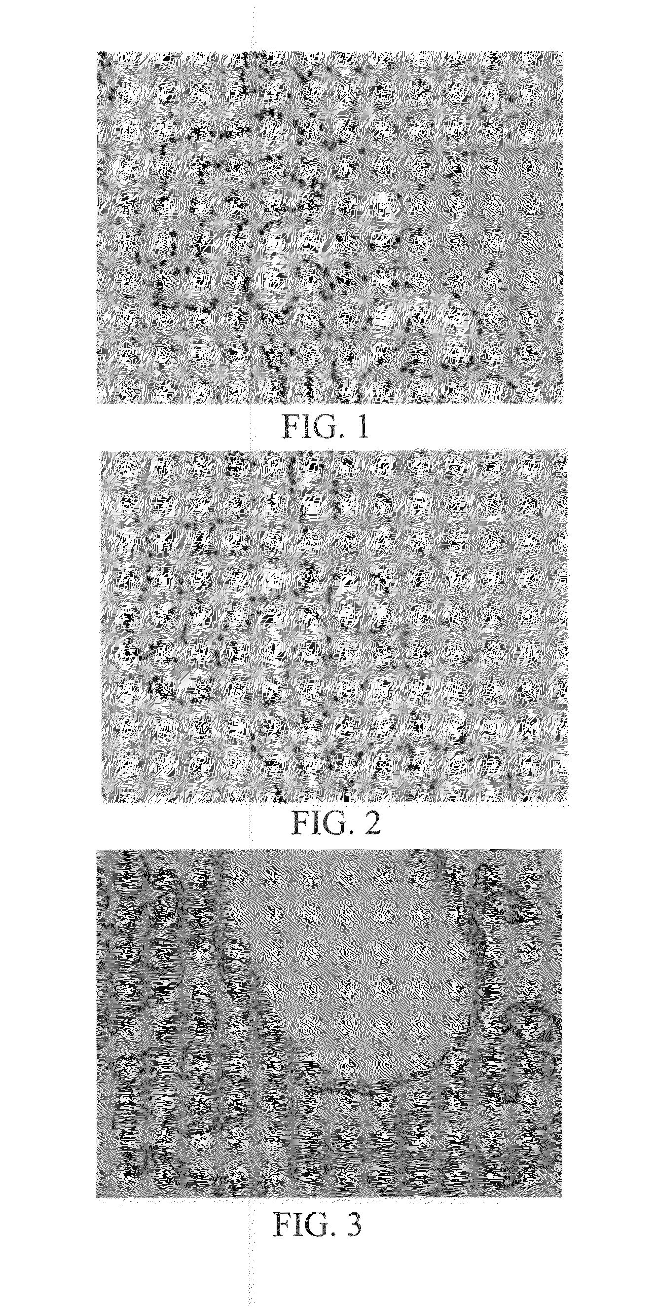 Systems and Methods for Anti-PAX8 Antibodies