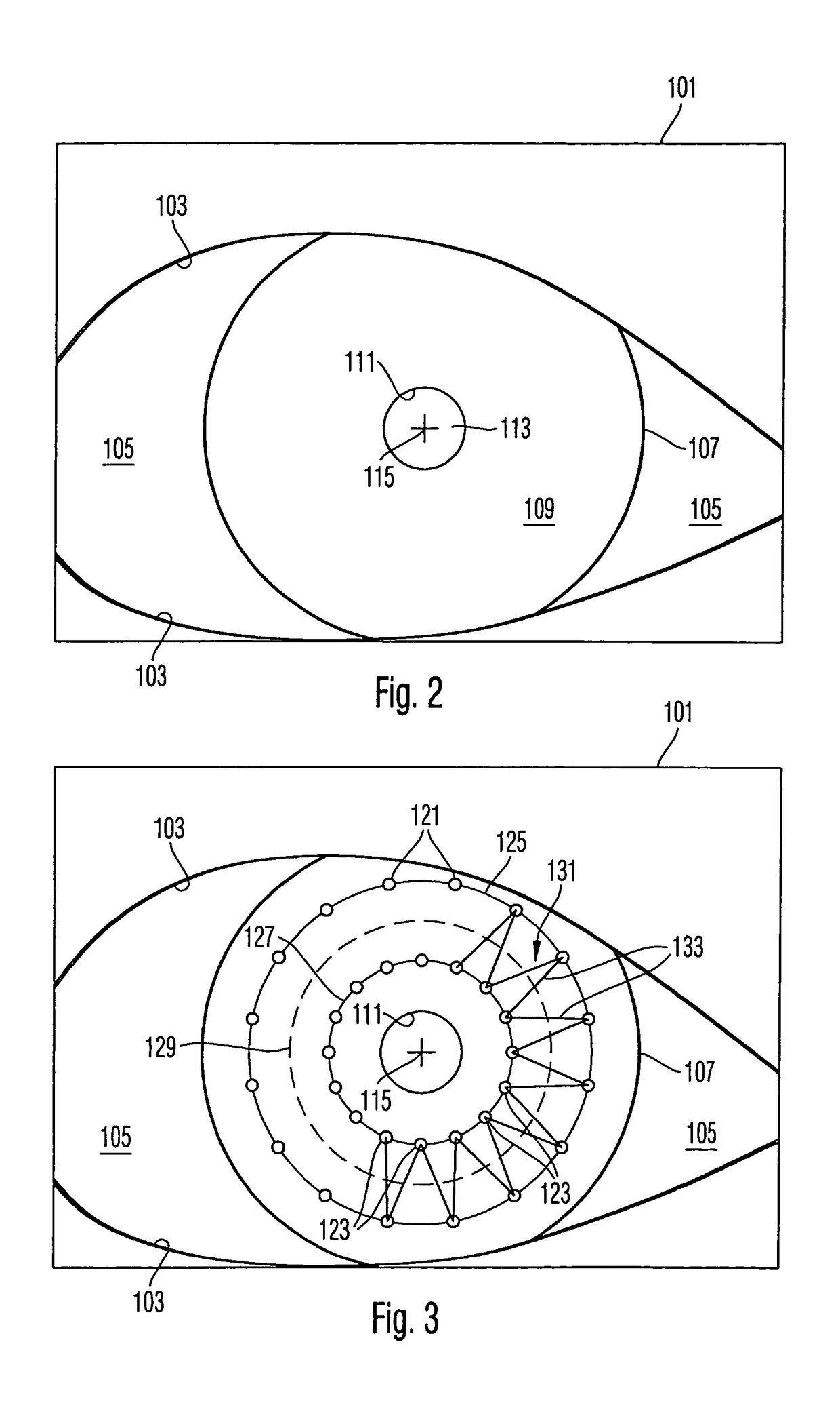 Surgical microscopy system and method for performing eye surgery