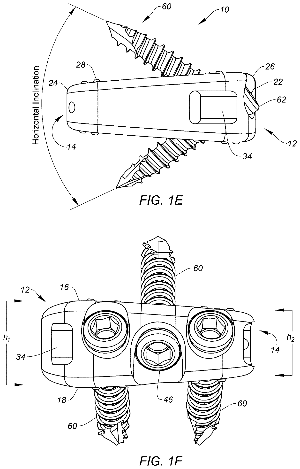 Spinal implants configured for tissue sparing angle of insertion and related methods