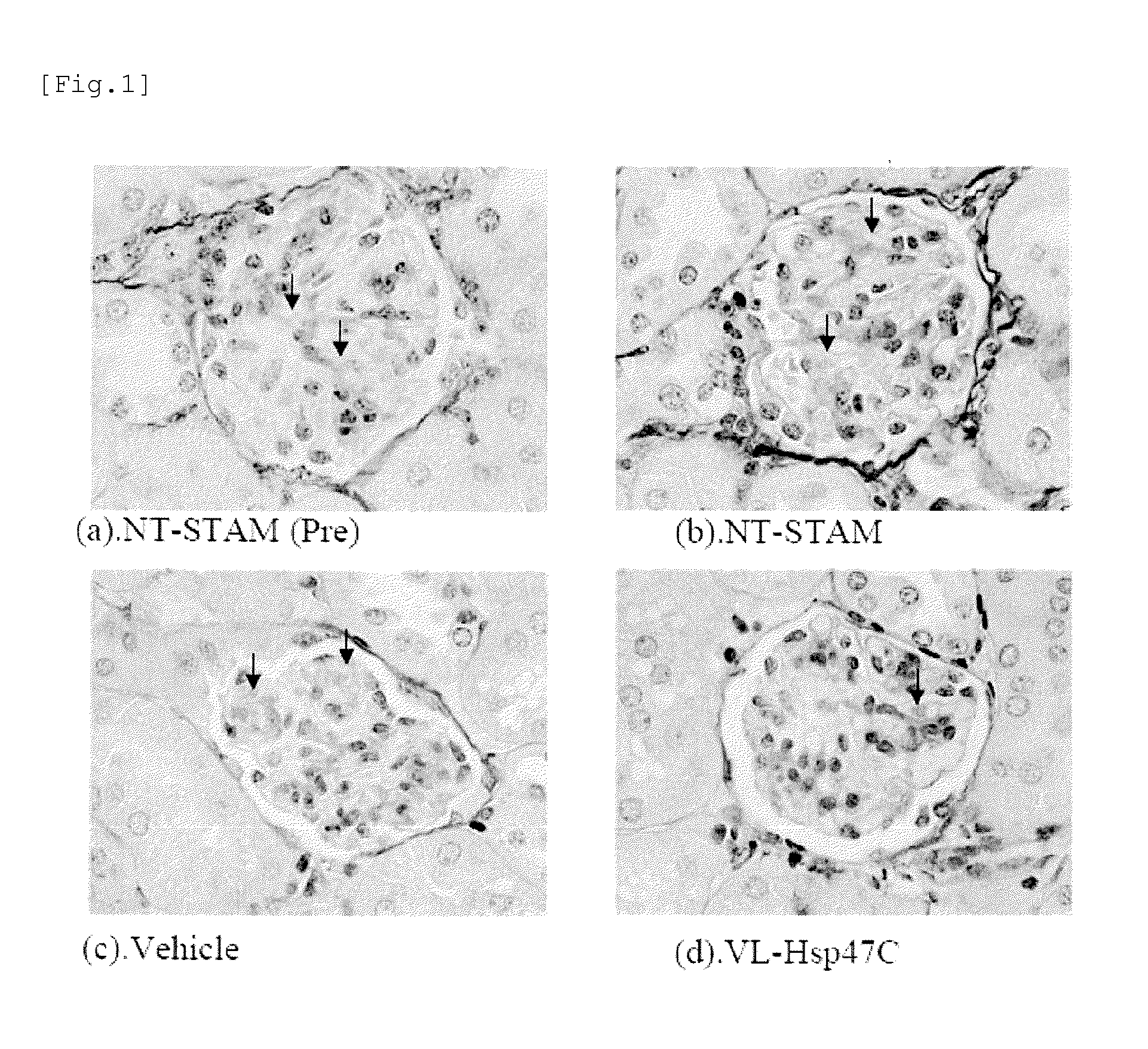 Agent for treating renal fibrosis