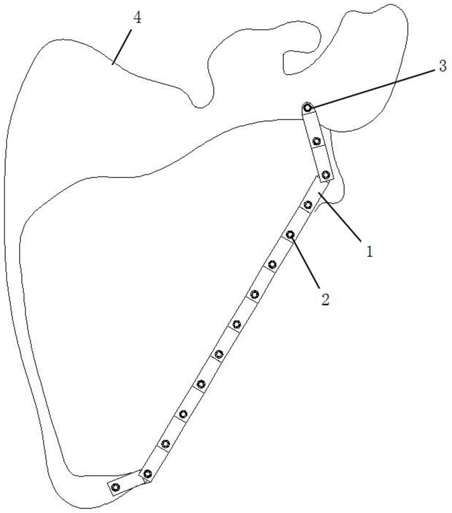 shoulder-blade-fracture-positioning-device-eureka-patsnap-develop