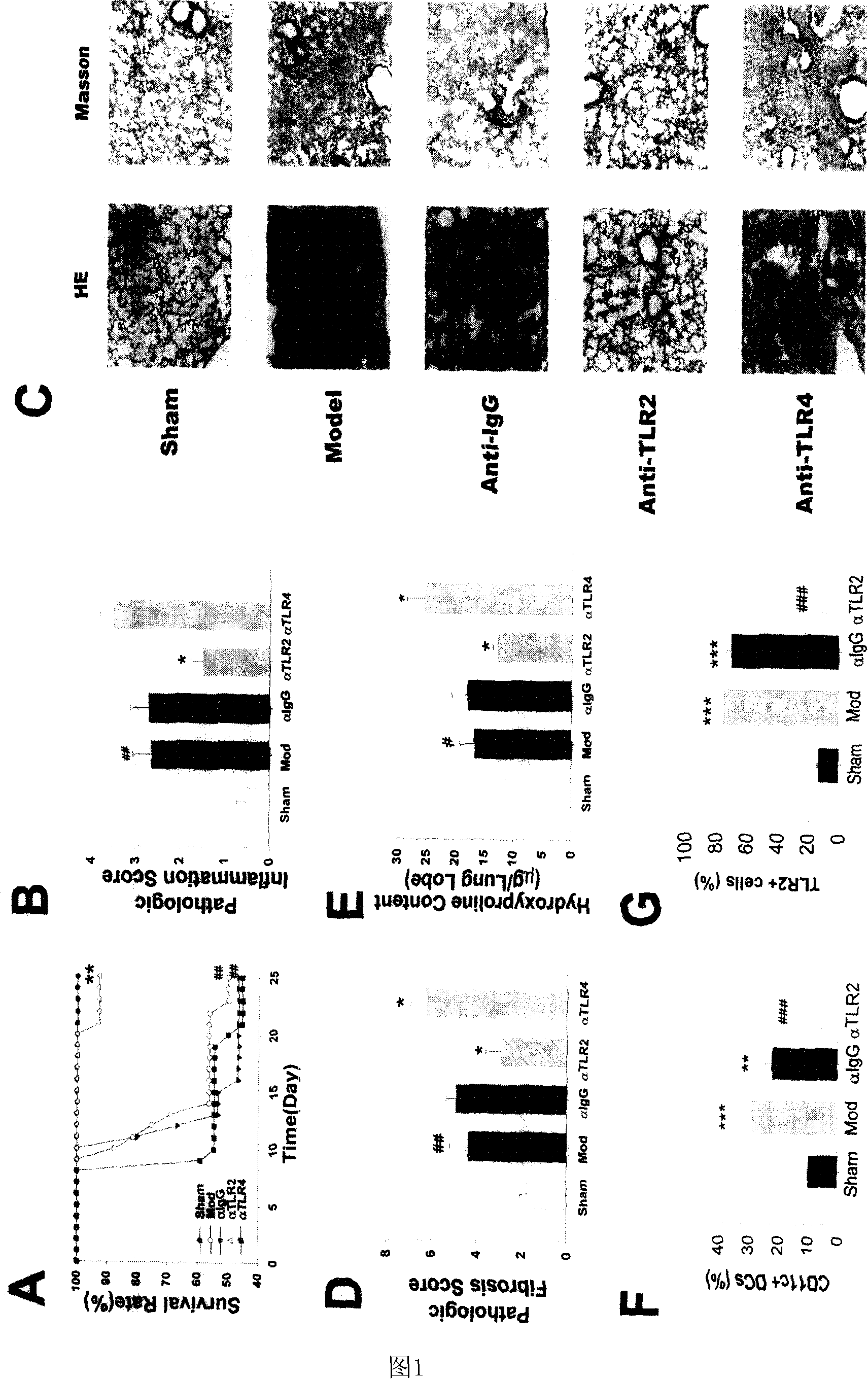 Anti Toll-like receptor 2 antibody anti pulmonary fibrosis use