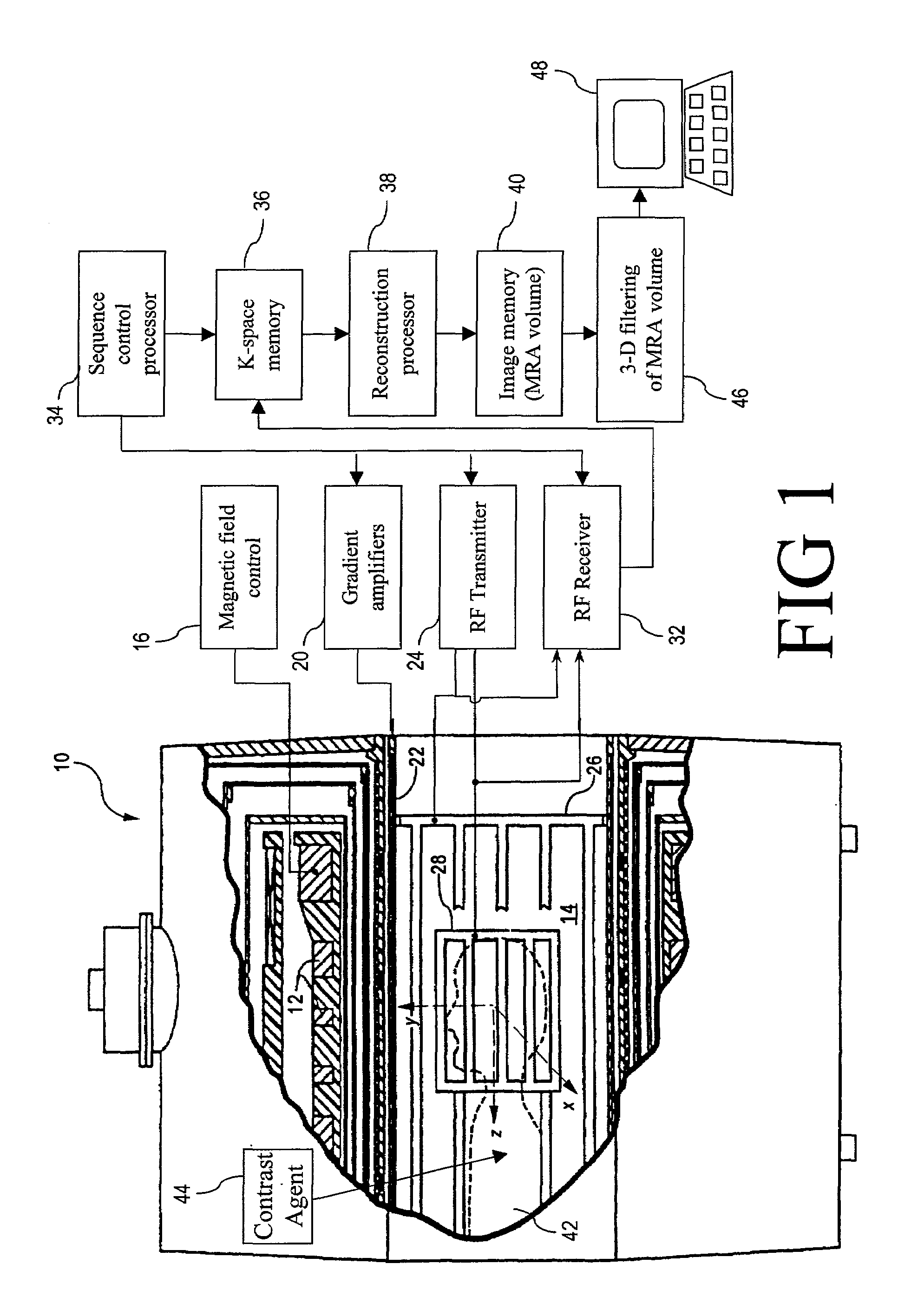 Method and apparatus for three-dimensional filtering of angiographic volume data