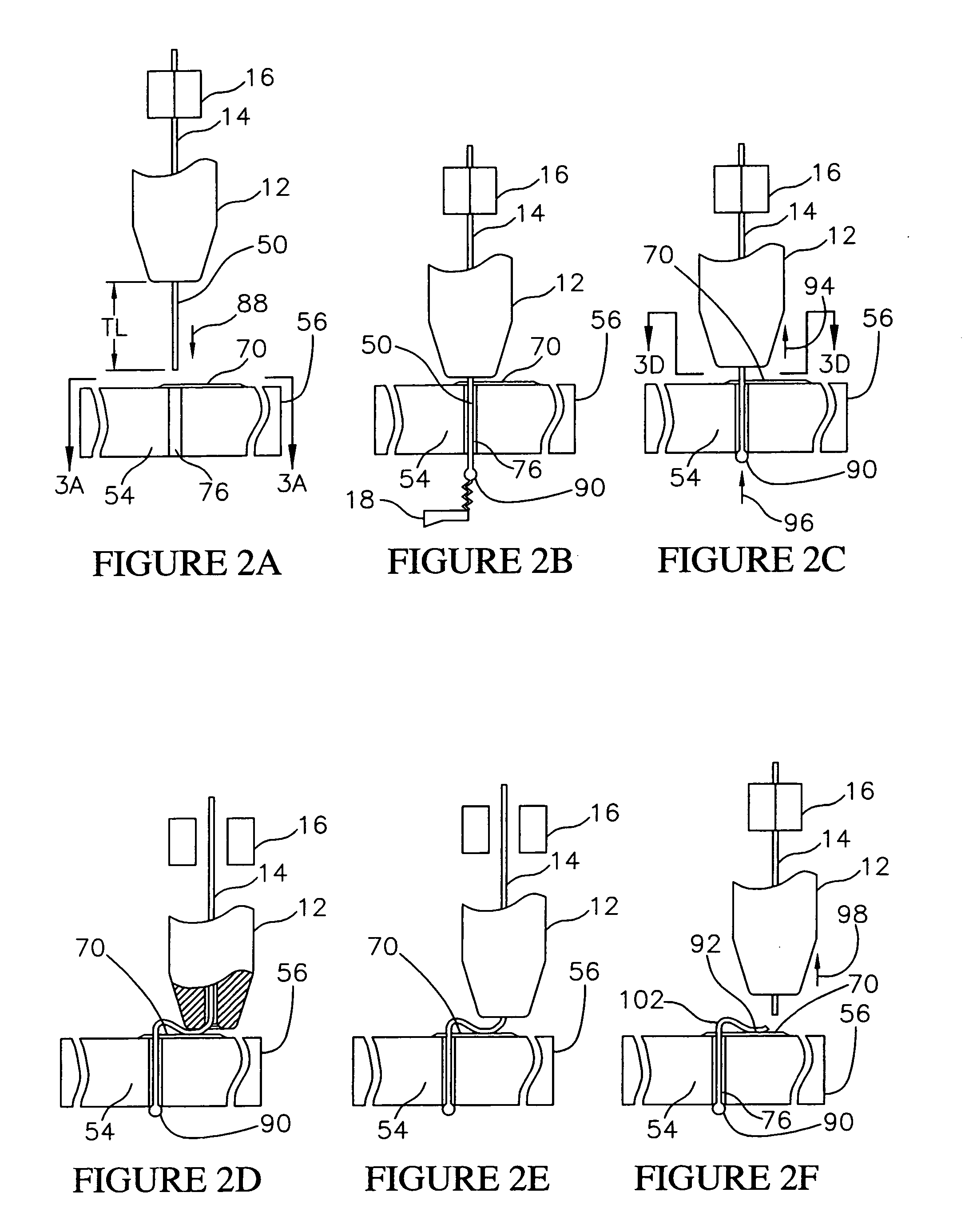 Method and system for fabricating semiconductor components with through wire interconnects