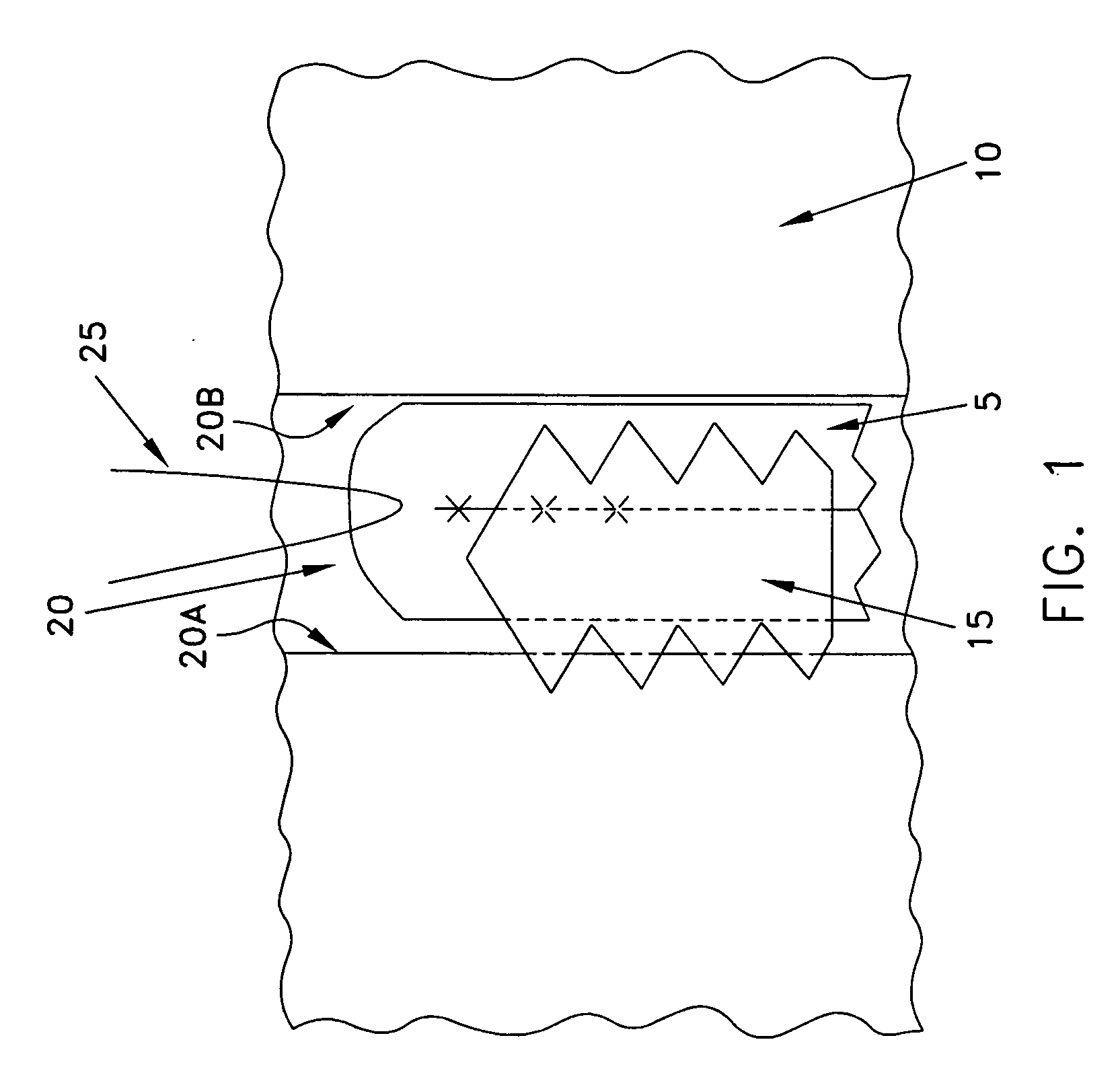 Composite interference screw for attaching a graft ligament to a bone, and other apparatus for making attachments to bone