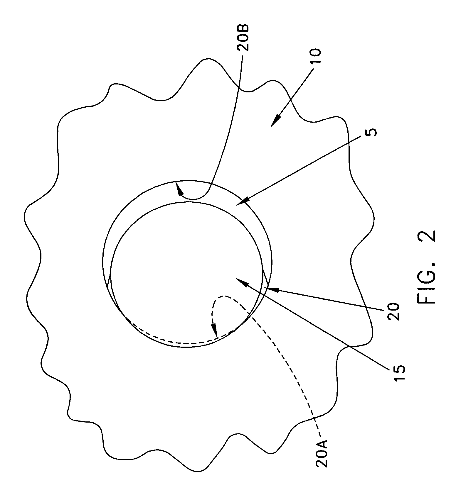 Composite interference screw for attaching a graft ligament to a bone, and other apparatus for making attachments to bone