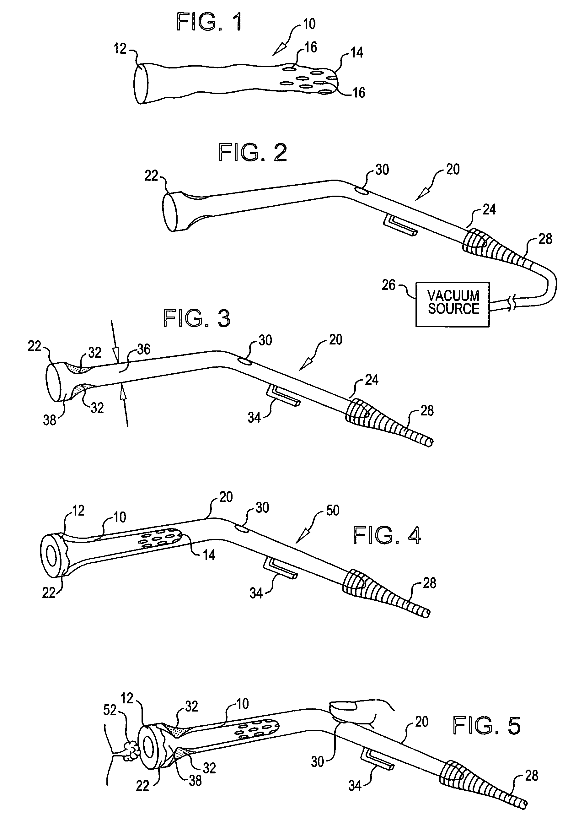 System and method for capturing body tissue samples