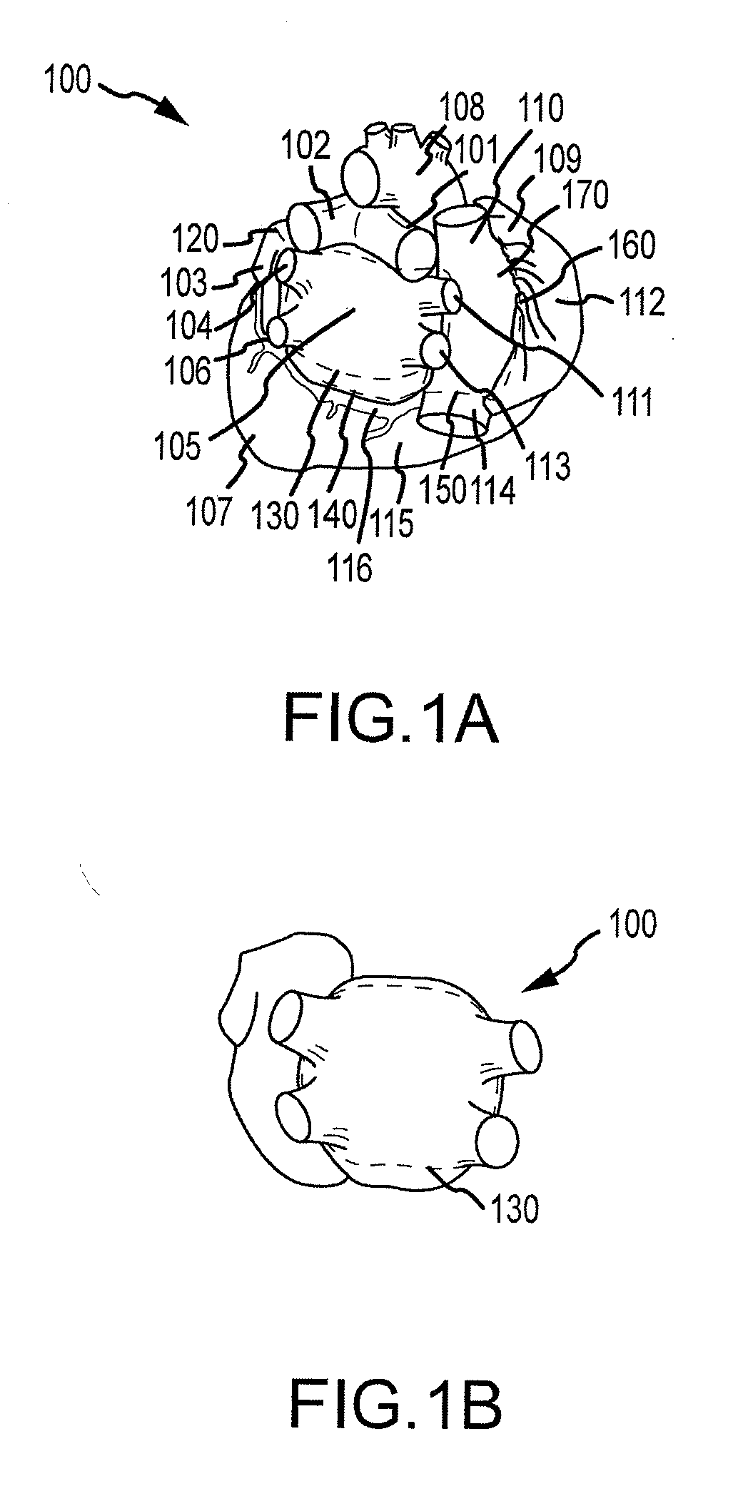 Cardiac ablation systems and methods