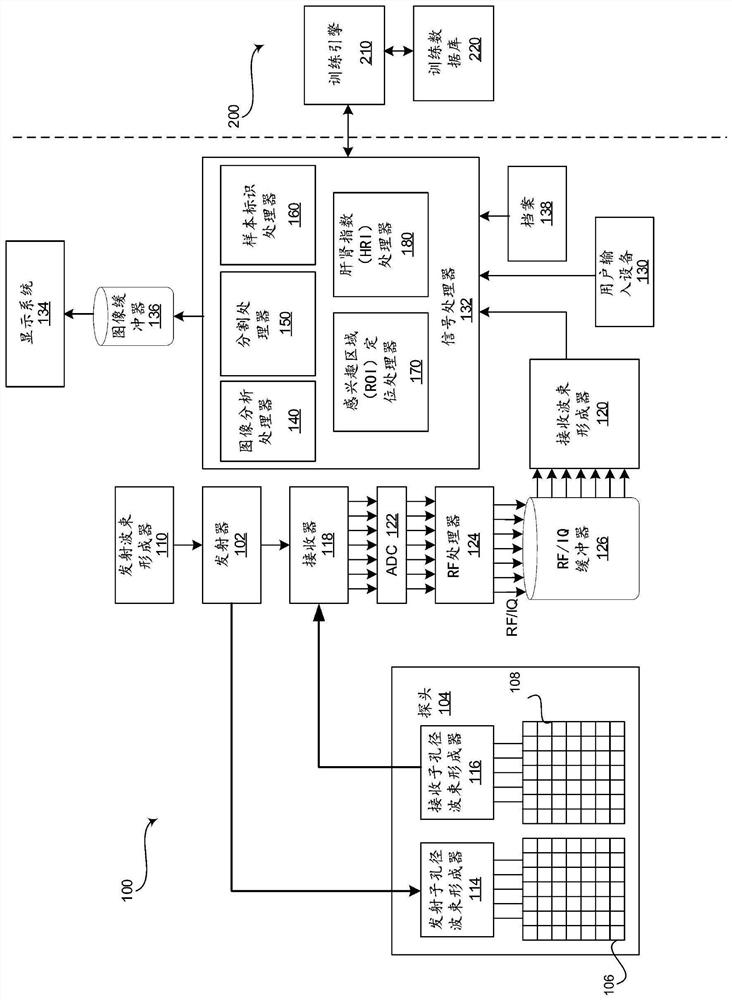 Method and system for automatically estimating hepatorenal index from ultrasound images