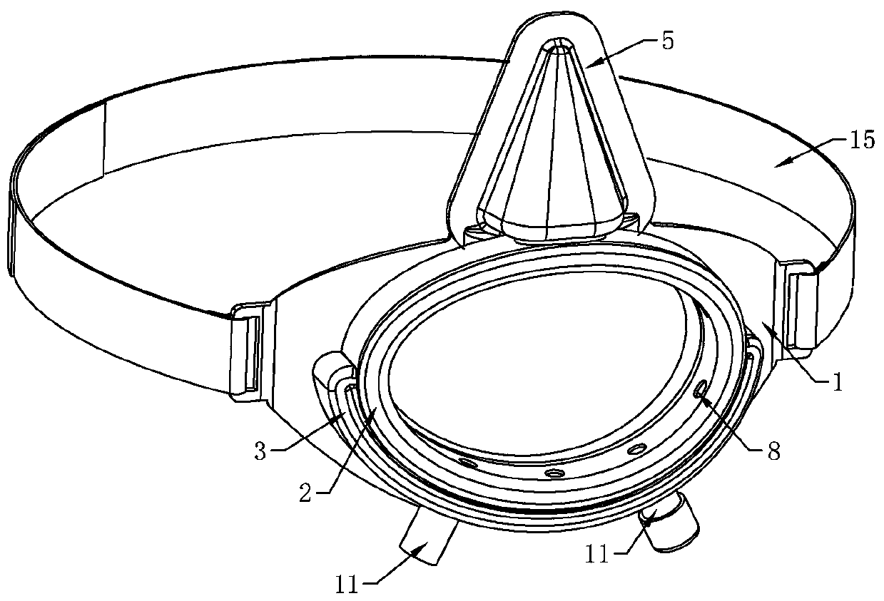 Special oral-nasal negative-pressure air extractor capable of preventing viruses from overflowing and used for tracheal intubation of patients infected with new coronaviruses