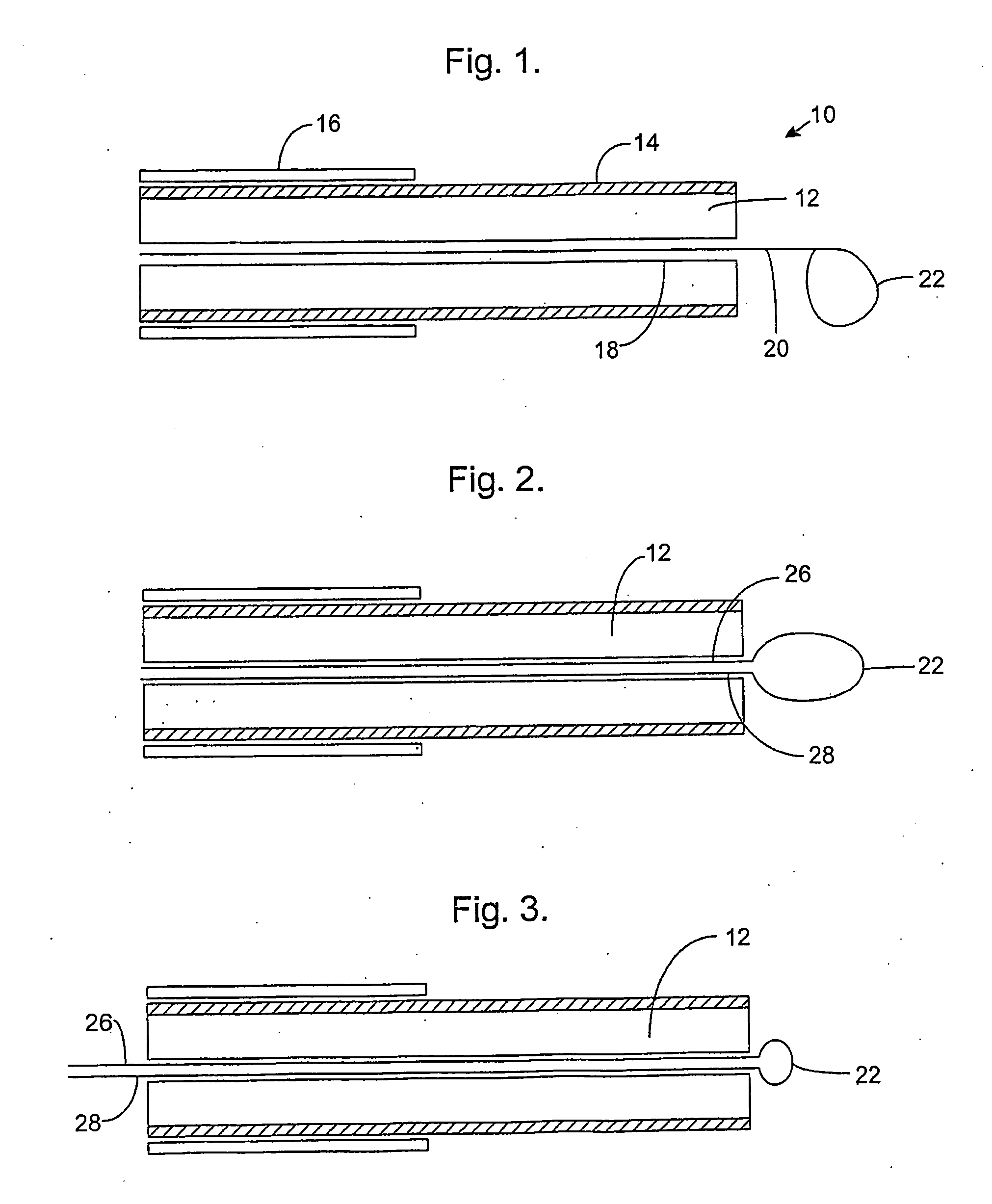 Catheter, Apparatus for Creating a Linear Ablation and a Method of Ablating Tissue