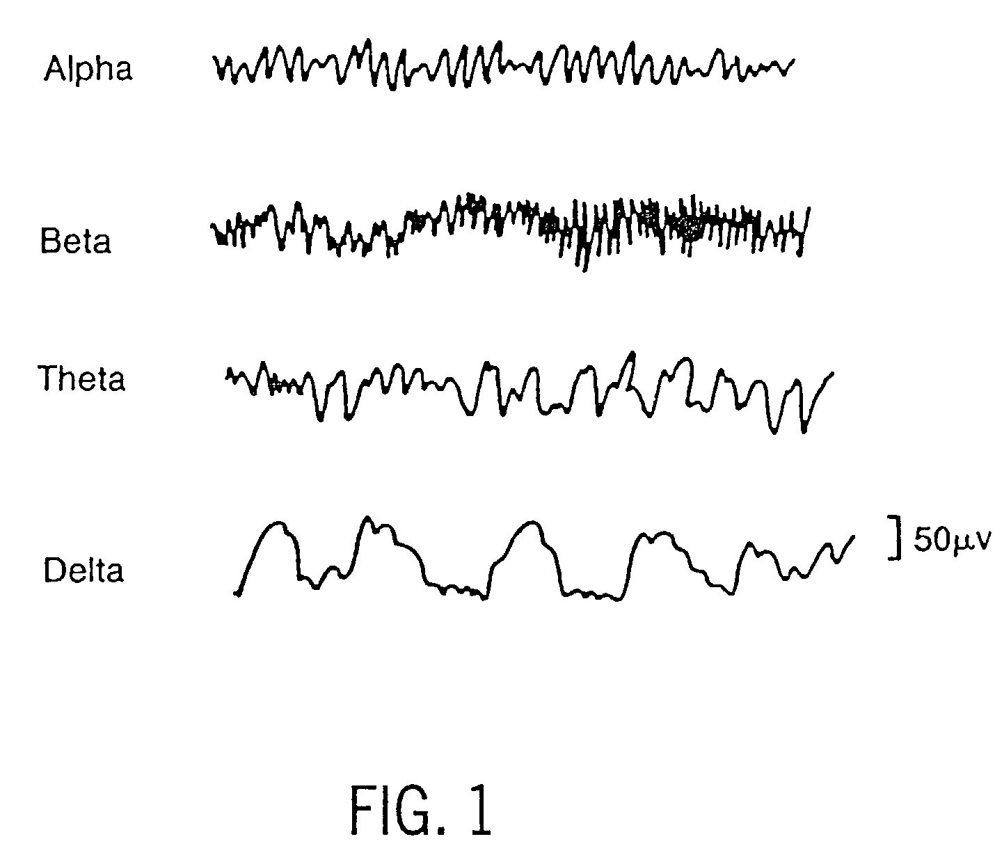 Method and apparatus for determining the cerebral state of a patient with fast response